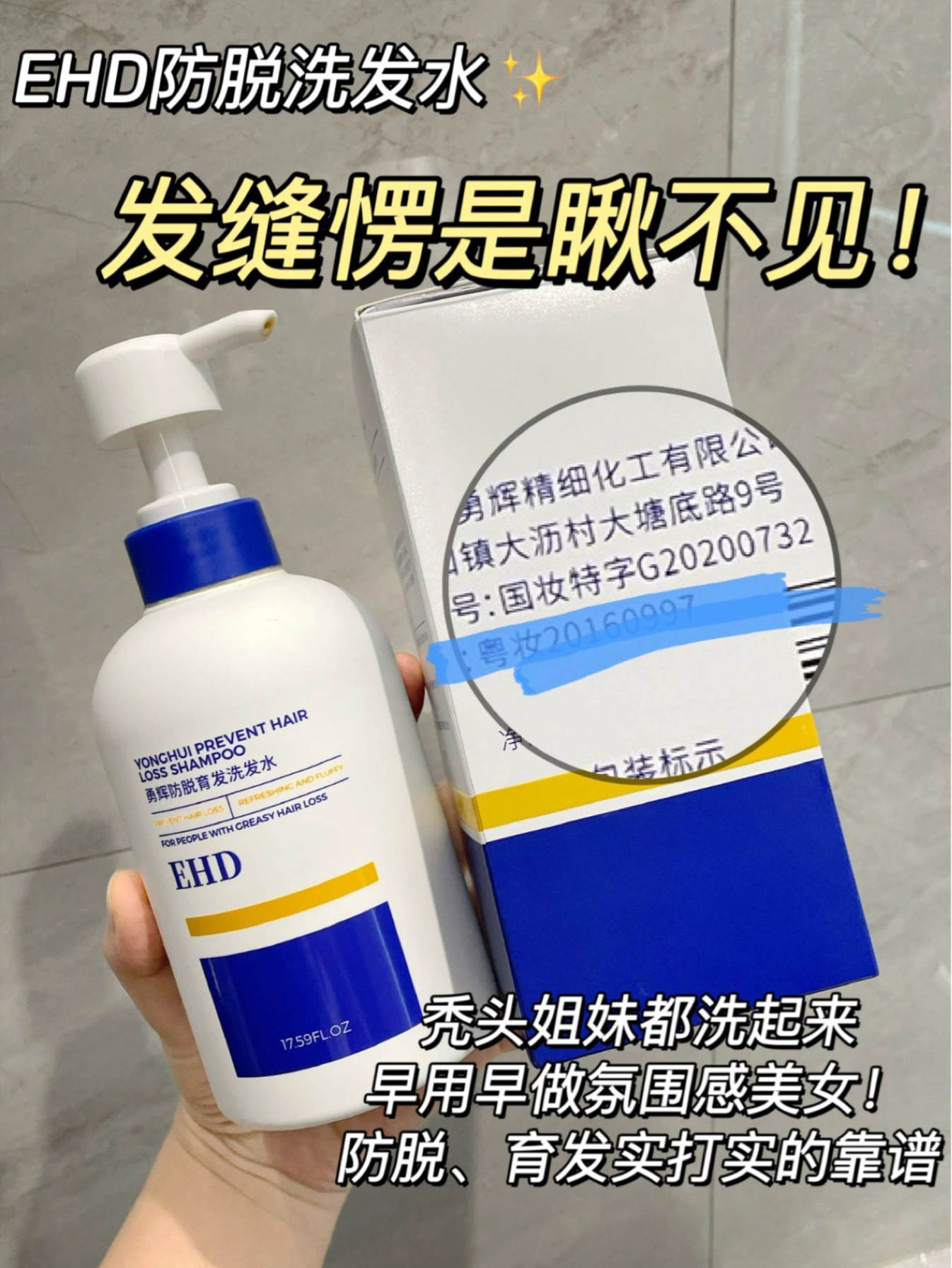 防脱不讲理！大发缝子都给填没了！