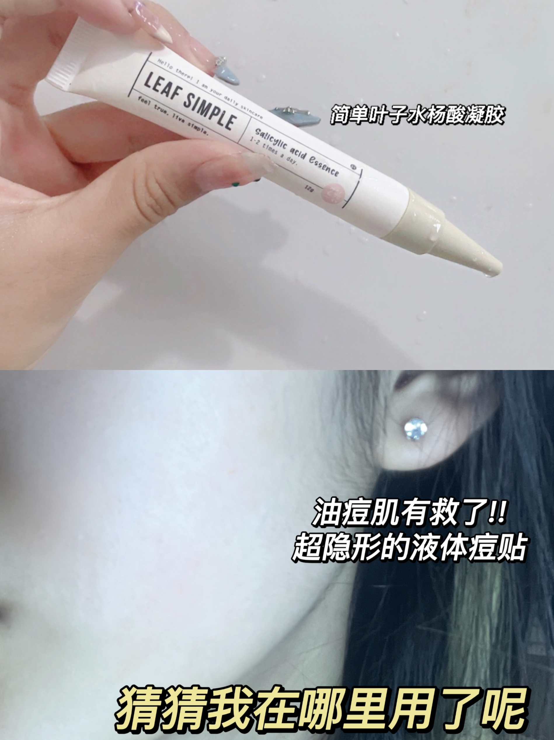 终于靠简单叶子打败了我的姨妈痘!!