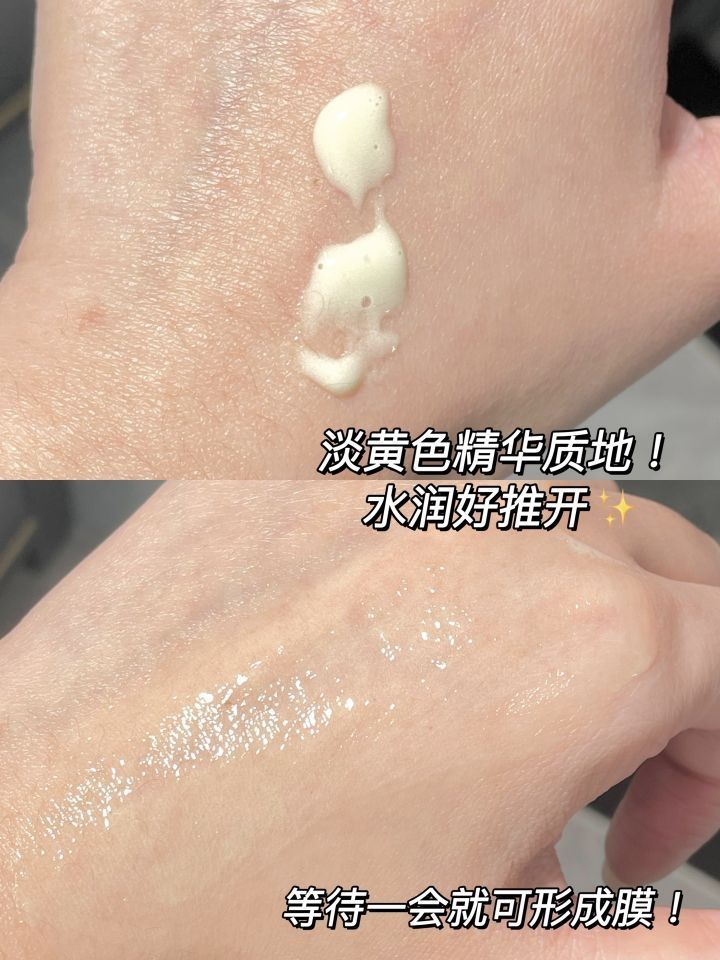痘肌跪谢！祛痘巨猛！痘痘再也困扰不了我了！