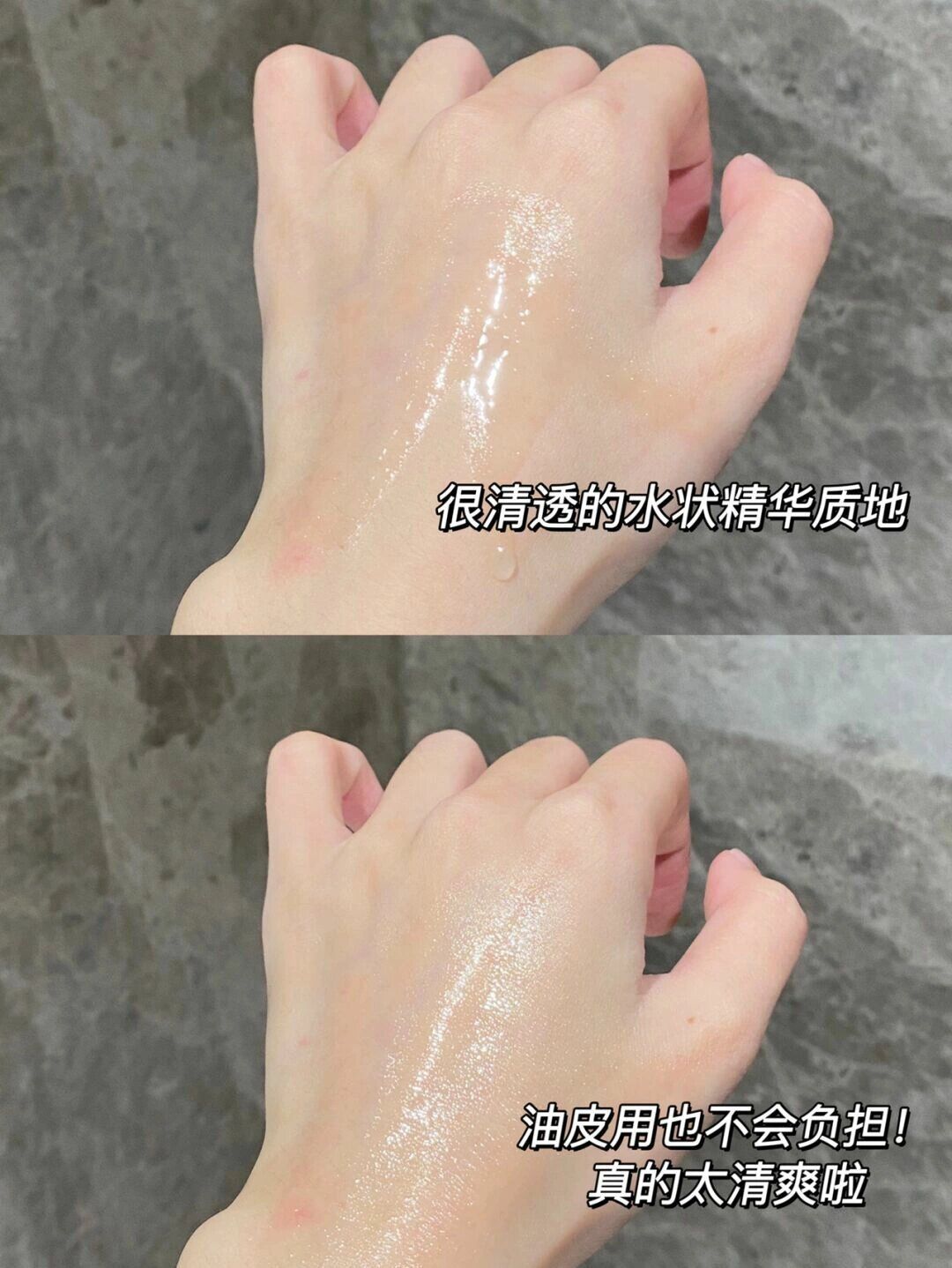 去黑头闭口我只服它！痘肌入股不亏！
