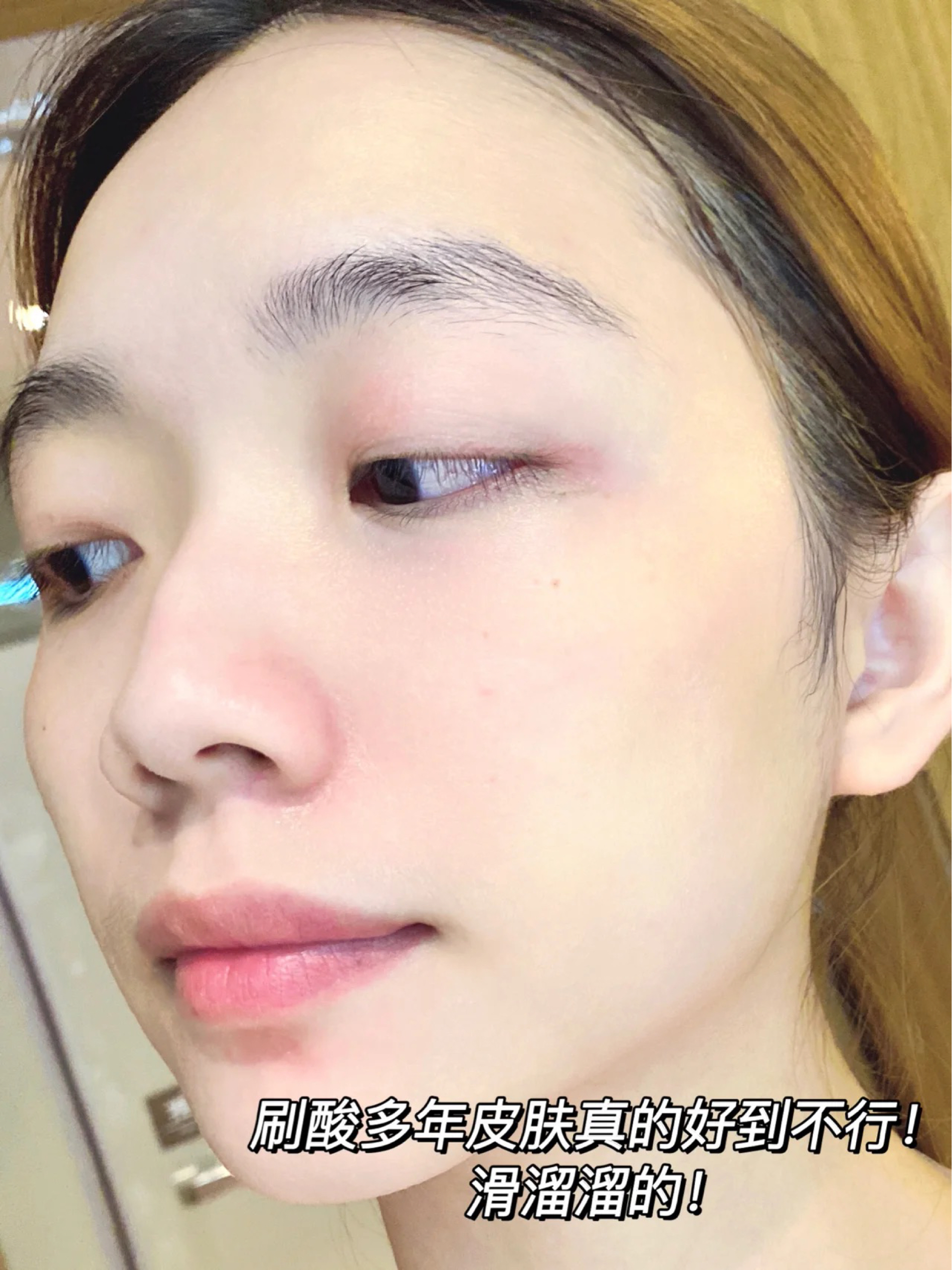 痘痘闭口瑟瑟发抖！土妞嫩成初恋脸！