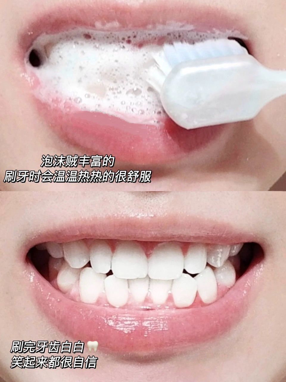 牙黄牙渍的姐妹刷它！低成本白牙还去口臭