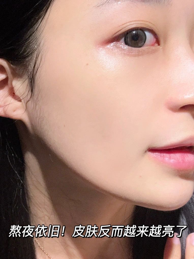 熬夜党黄皮超爱的精华！去黄提亮敏感肌也可