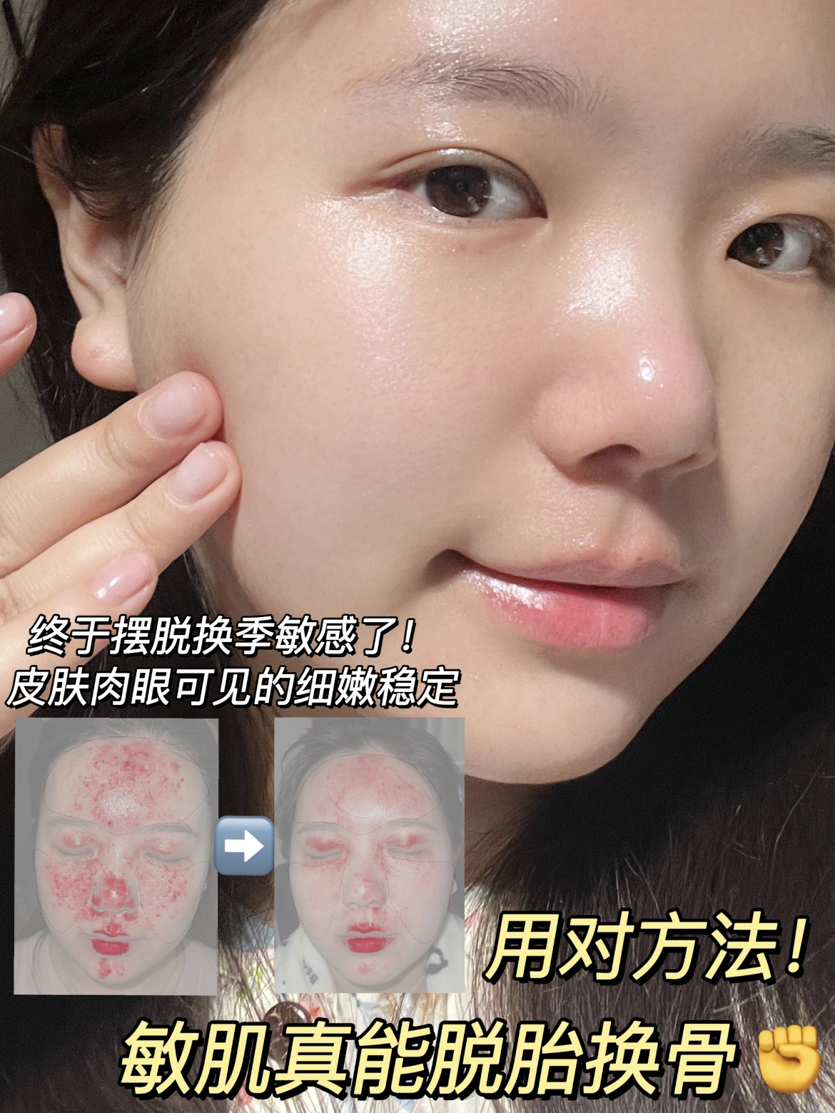 舒缓喷雾，用对摆脱换季烂脸