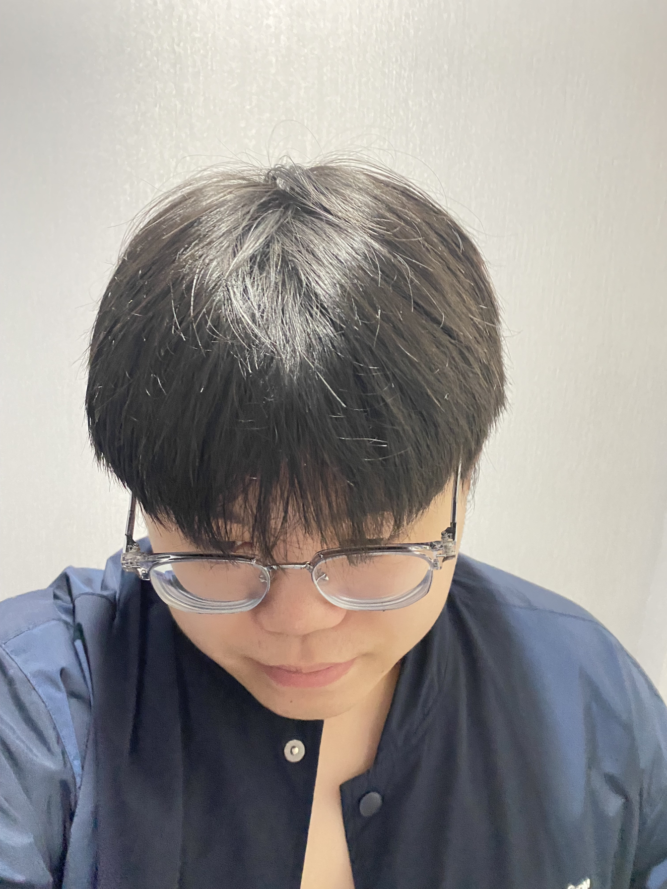 这小东西，我熬夜掉的发都养回来了！