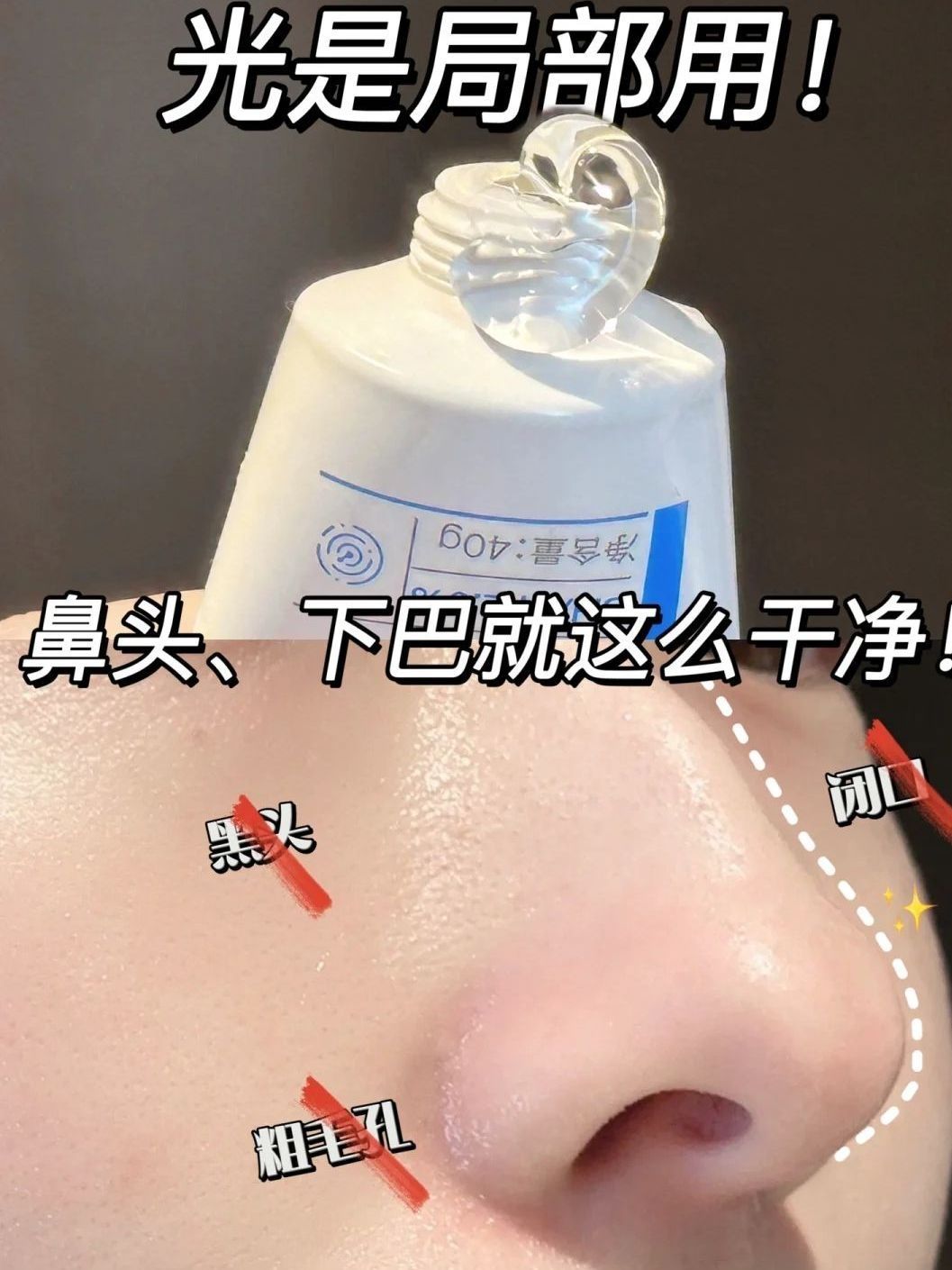 必囤抗痘面膜！油皮痘肌变成牛奶皮不是梦!😌