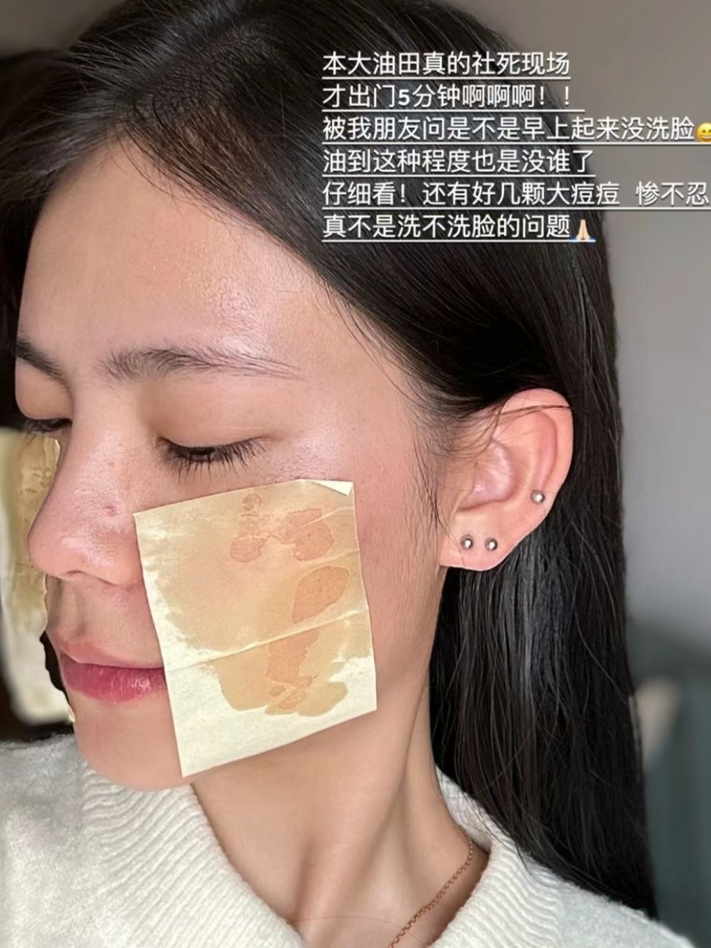 油痘肌熬夜的底气！全是这套水乳给的!