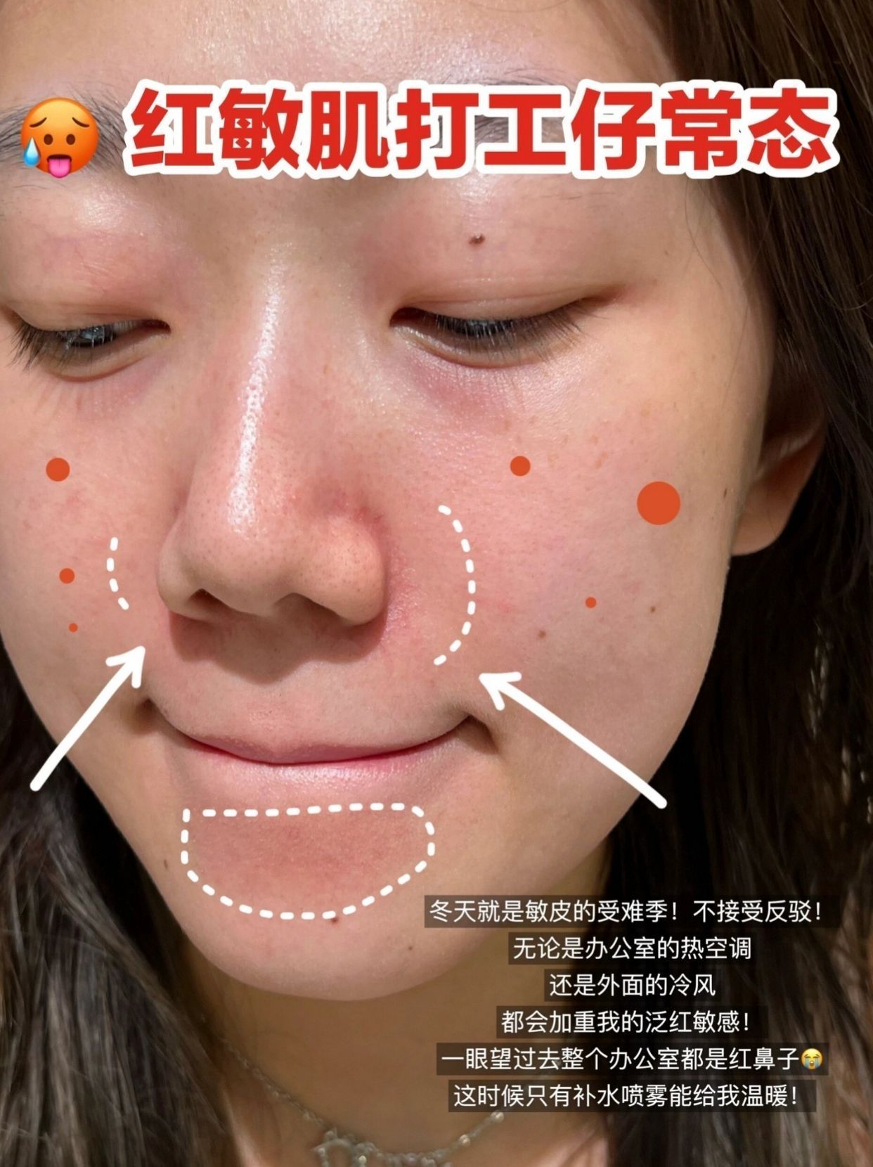 换季红敏❓喷雾的正确打开方式❗️❗️