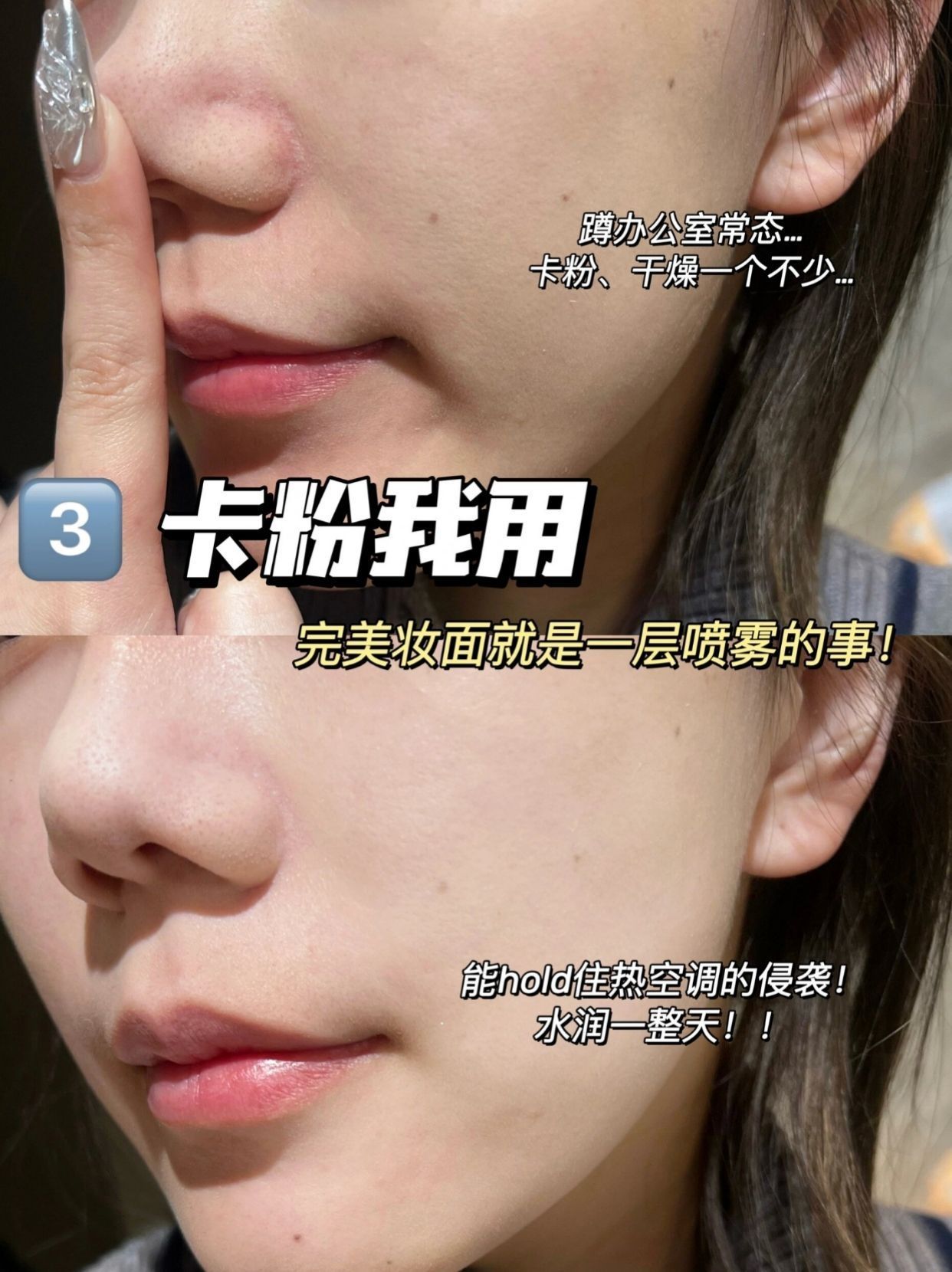 换季红敏❓喷雾的正确打开方式❗️❗️