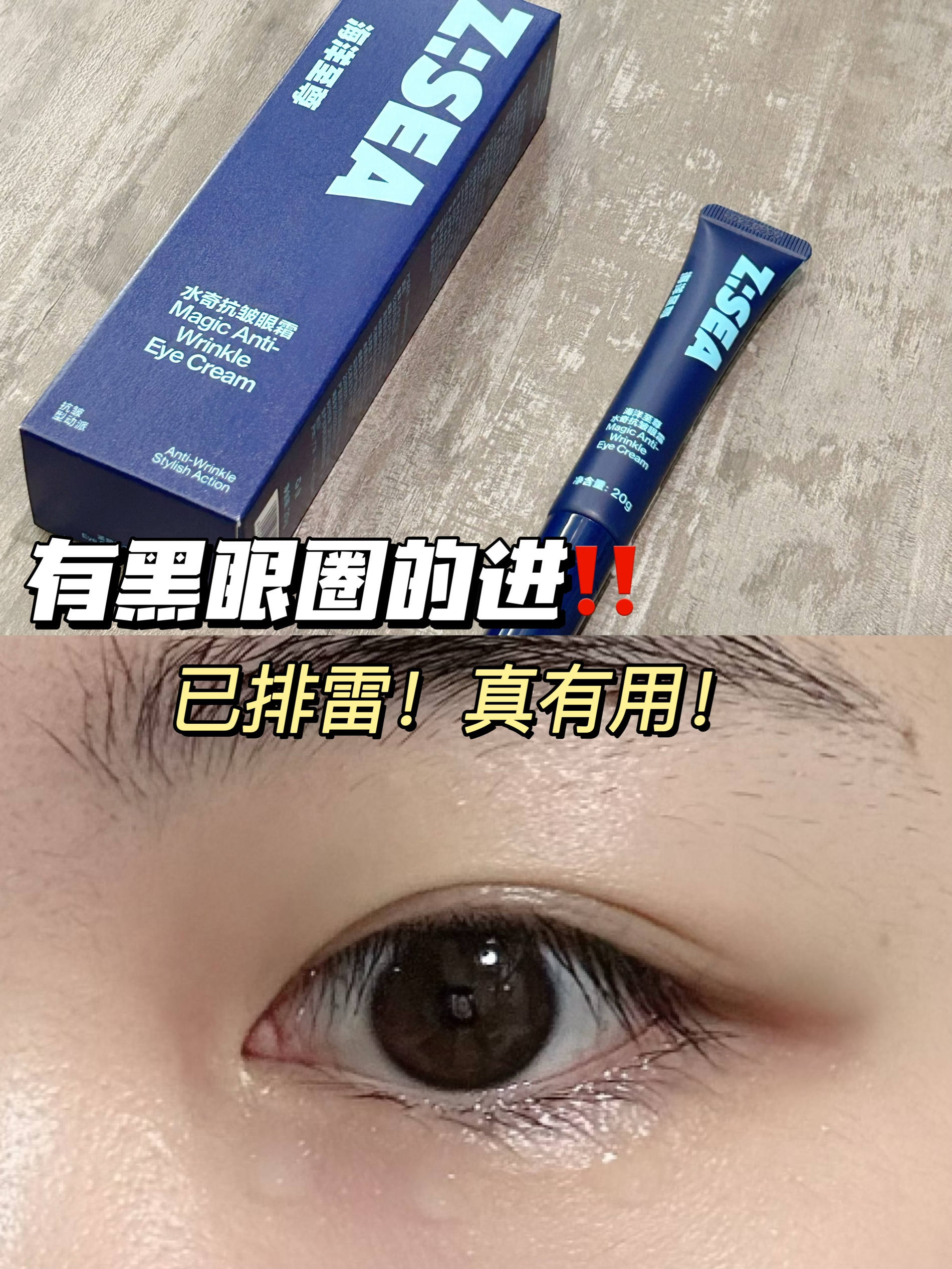做美女第一步！告别黑眼圈