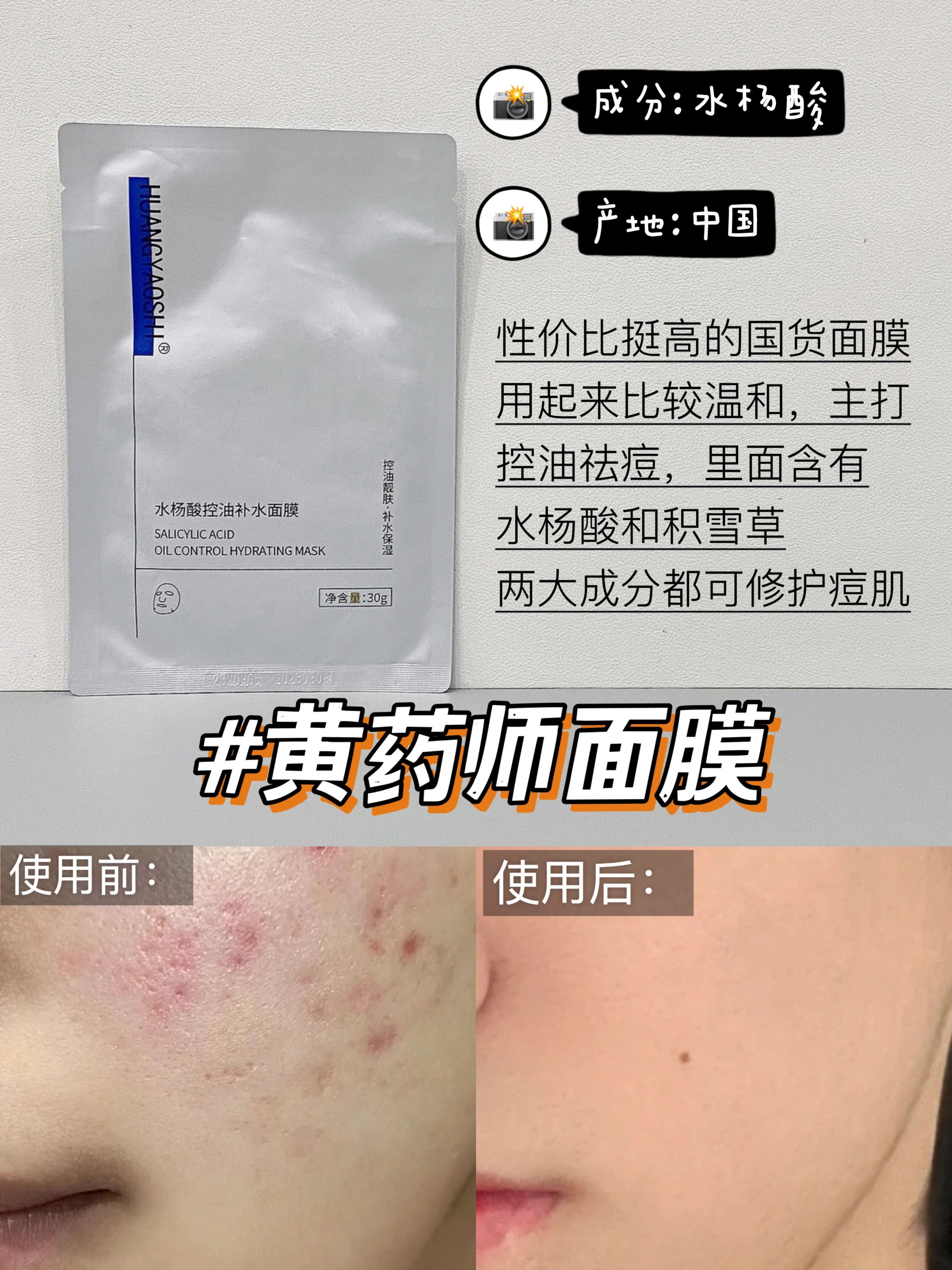 学生党护肤装,新品春季男士面膜控油篇