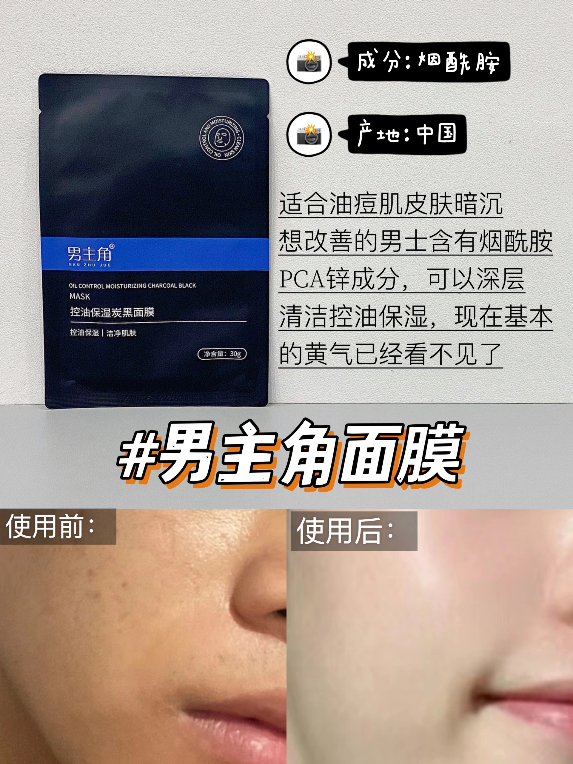 学生党护肤装,新品春季男士面膜控油篇