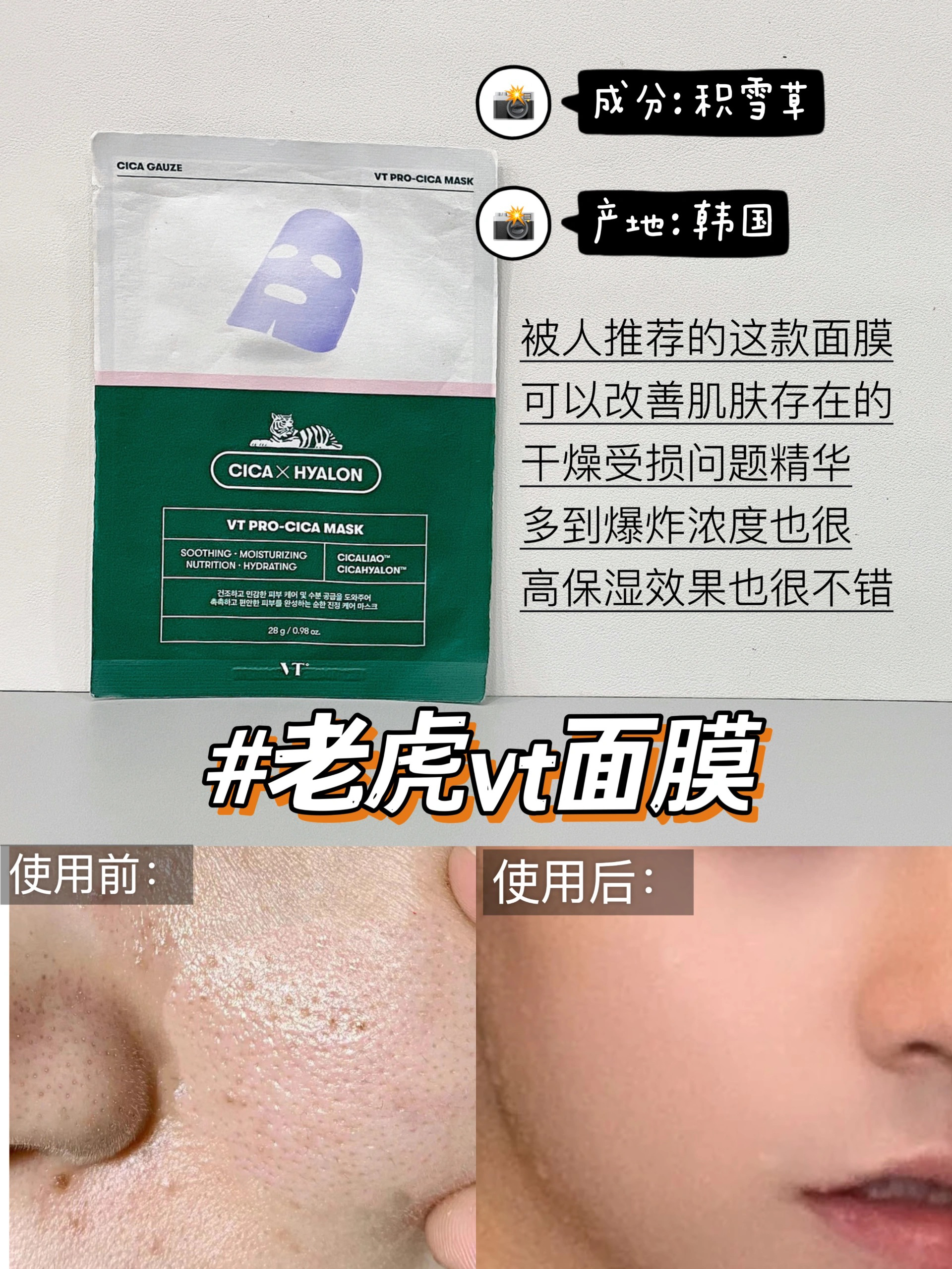学生党护肤装,新品春季男士面膜控油篇