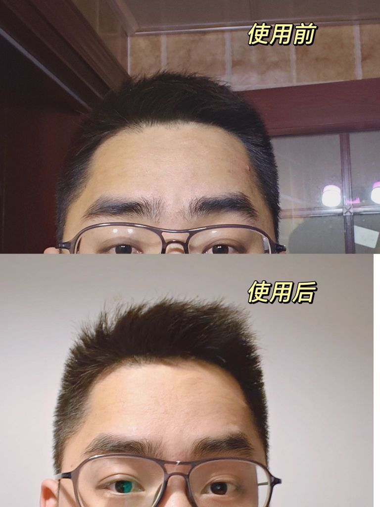 我的宝藏洗发水带我做干净清爽的自己