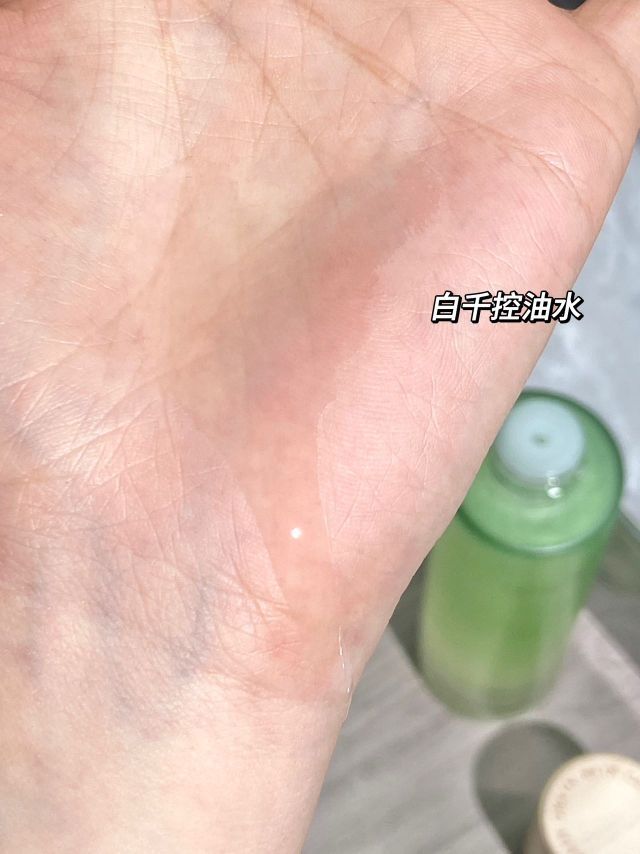 油痘肌的安全感…真的靠实力在说话!