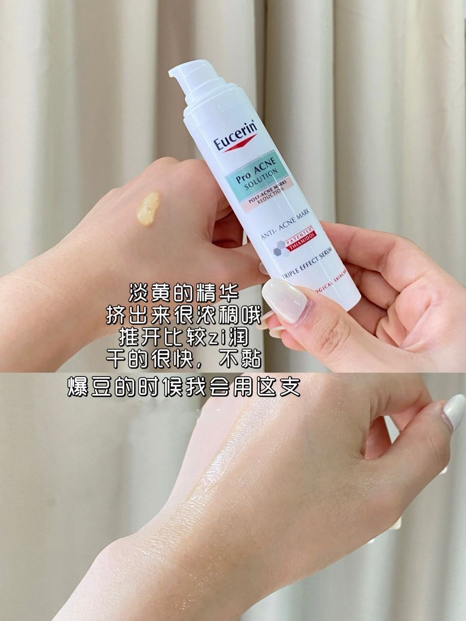 油痘肌真的给跪了💕这精华祛痘印闭口真牛