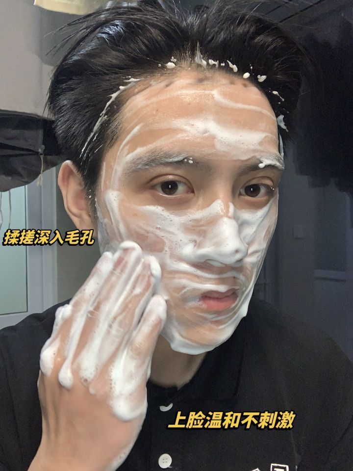 没痘前都被同学夸是校草.......