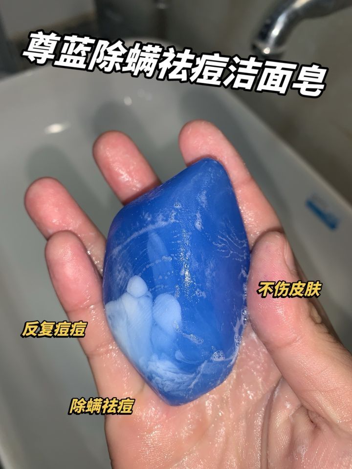 没痘前都被同学夸是校草.......