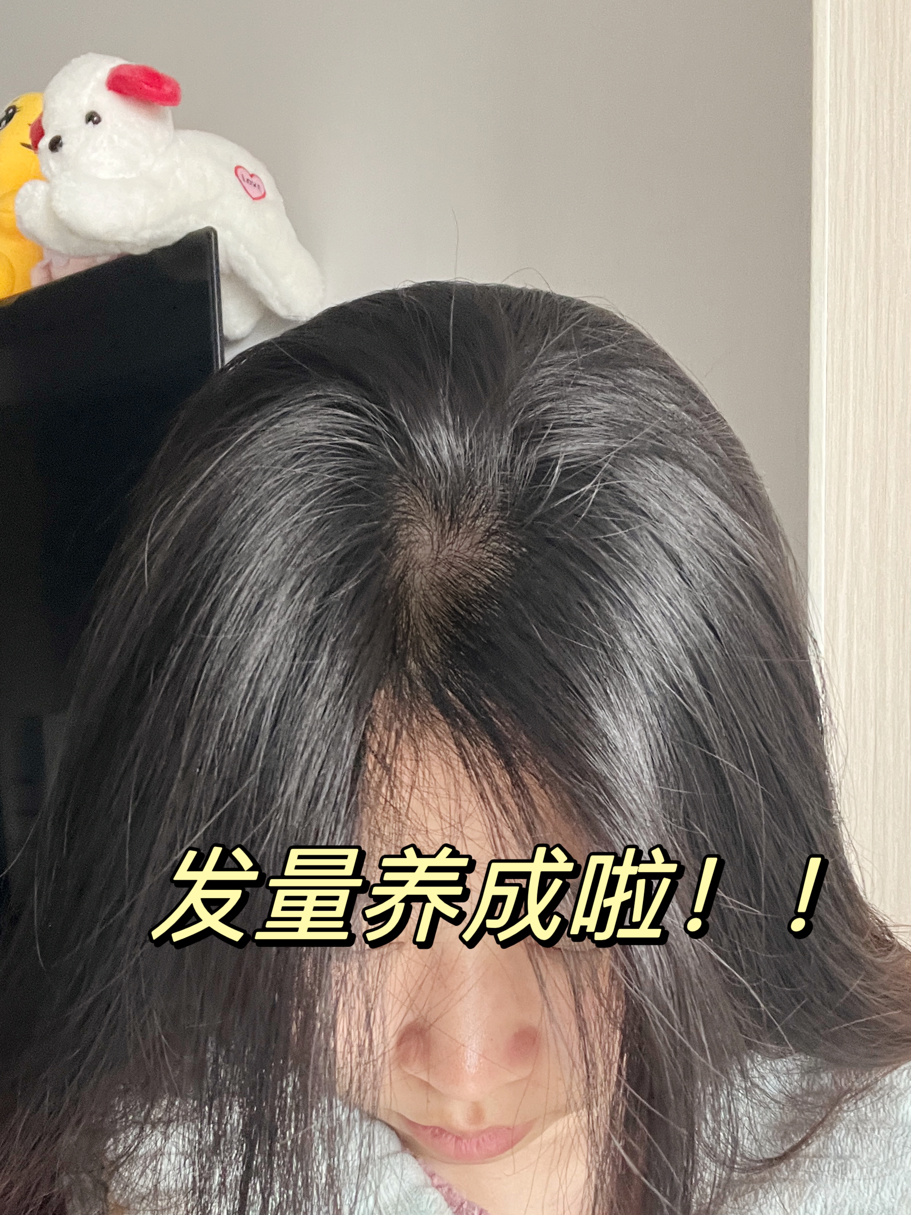 秃头姐妹快试试这个方法！真的牛！