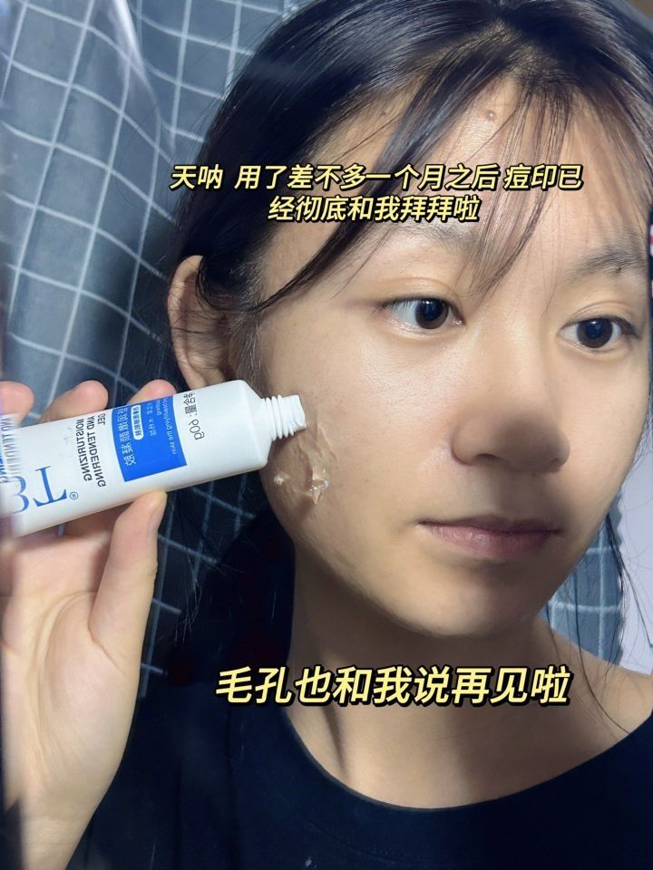 惊呆了！痘印这么快和我说拜拜了👋
