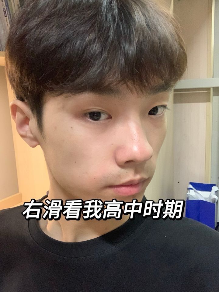 高中三年不祛痘，大学四年没对象