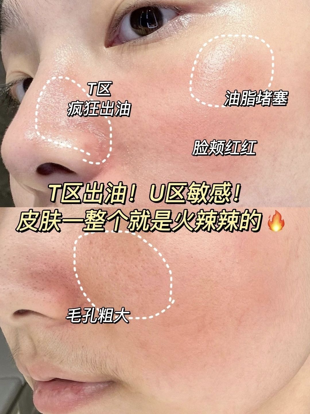 油敏皮的红脸蛋有救了！这控油修护水乳真🐮