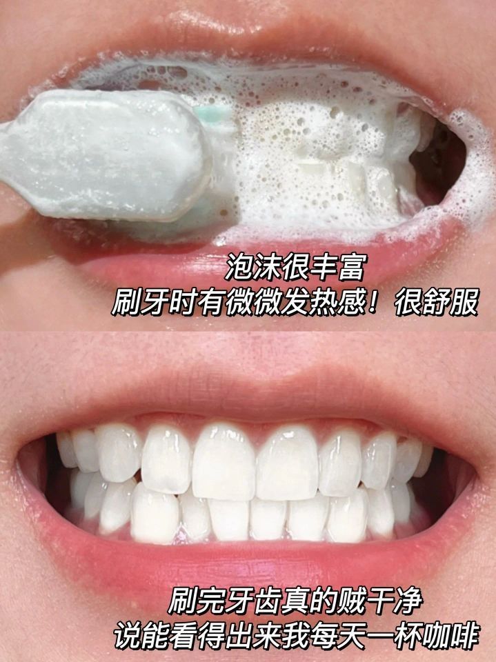我愿称之为报恩牙膏！黄牙口气通通消灭㊙️