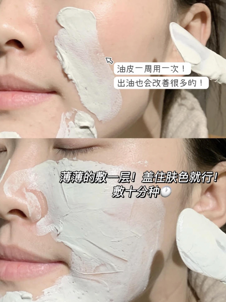 逼跑黑头闭口！这泥膜太狠了！