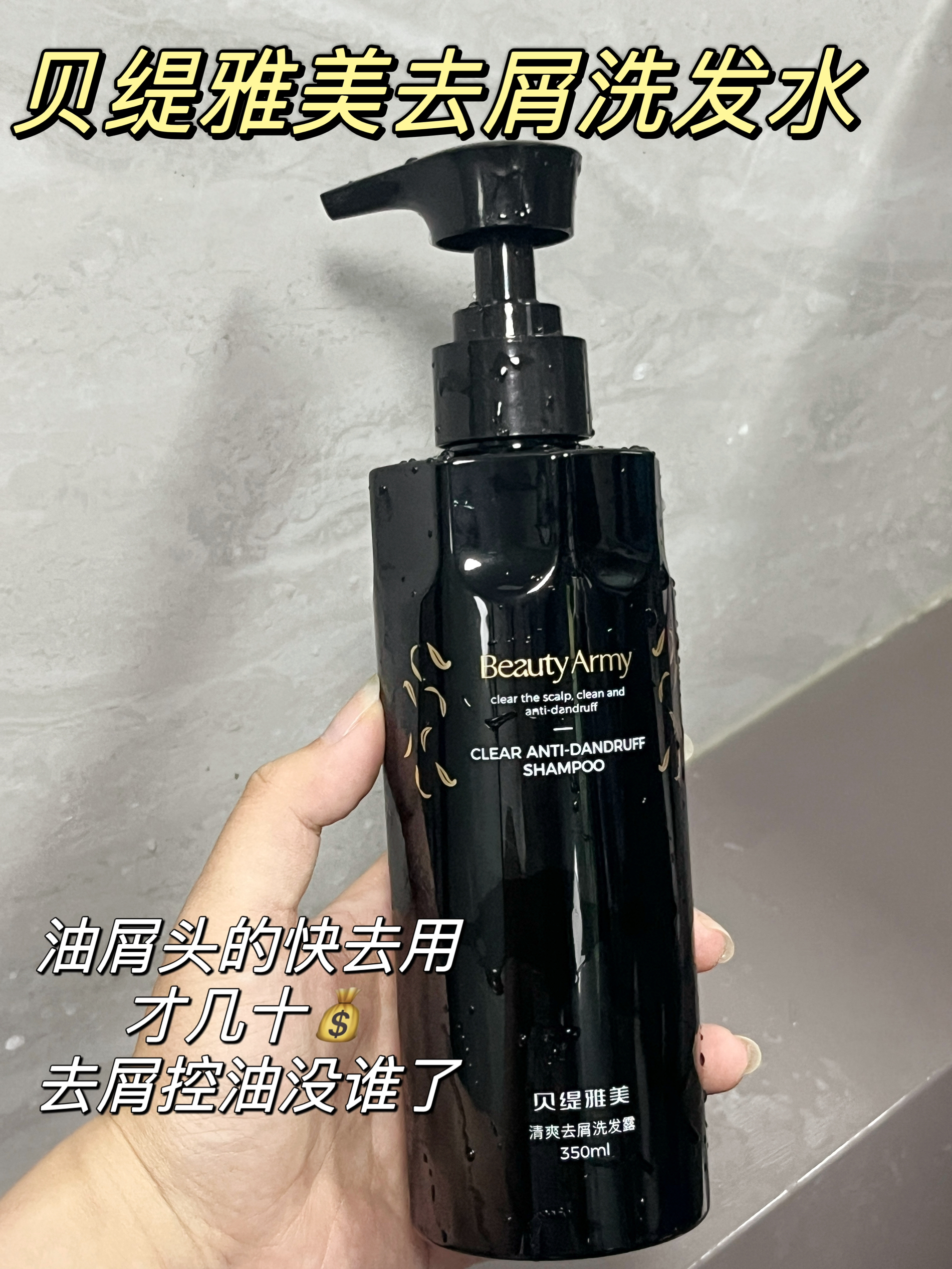 昨天才洗的头！油屑头一整个社死！