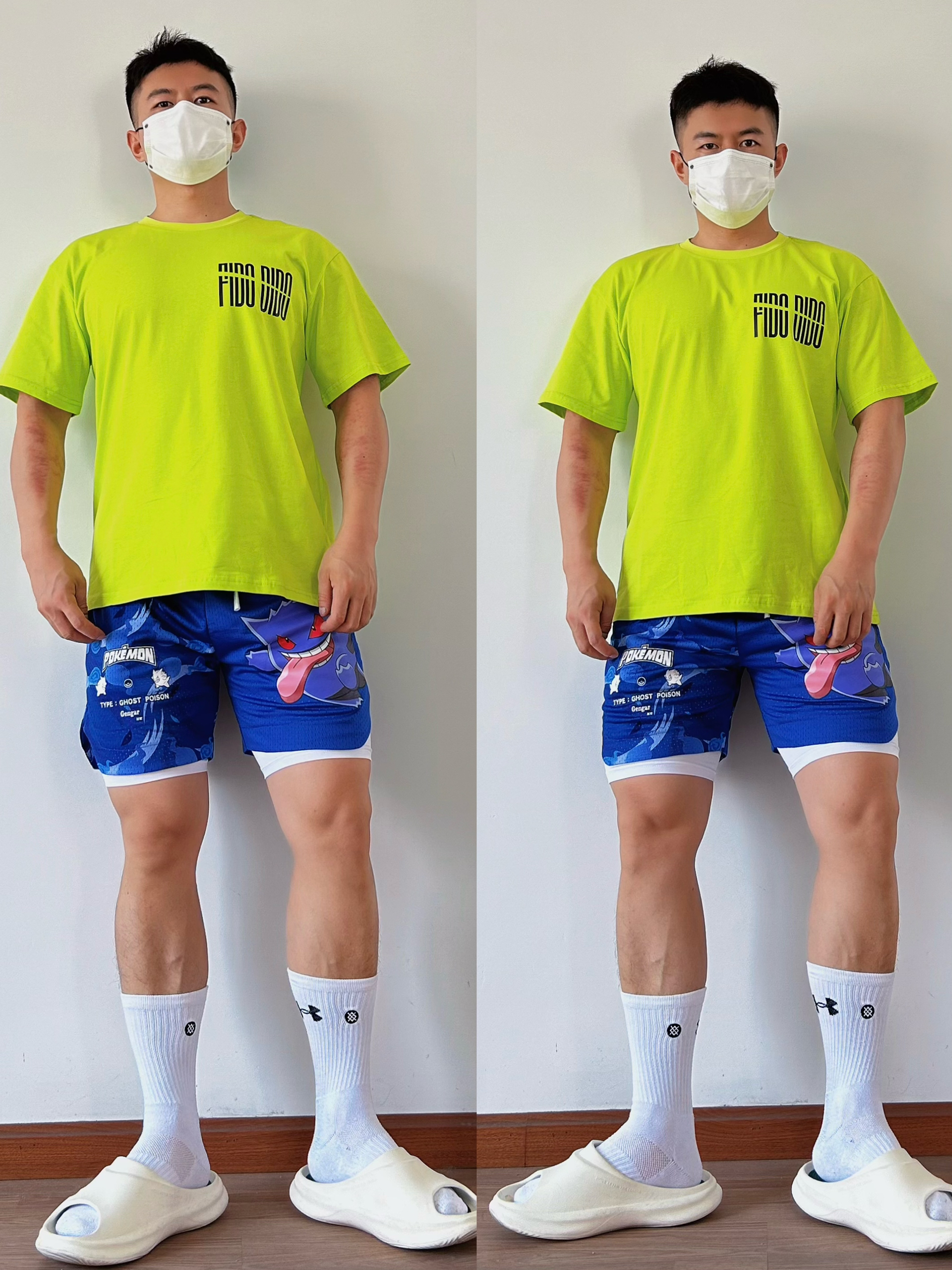 OOTD | 💥粗腿男生的多巴胺夏日穿搭🔥