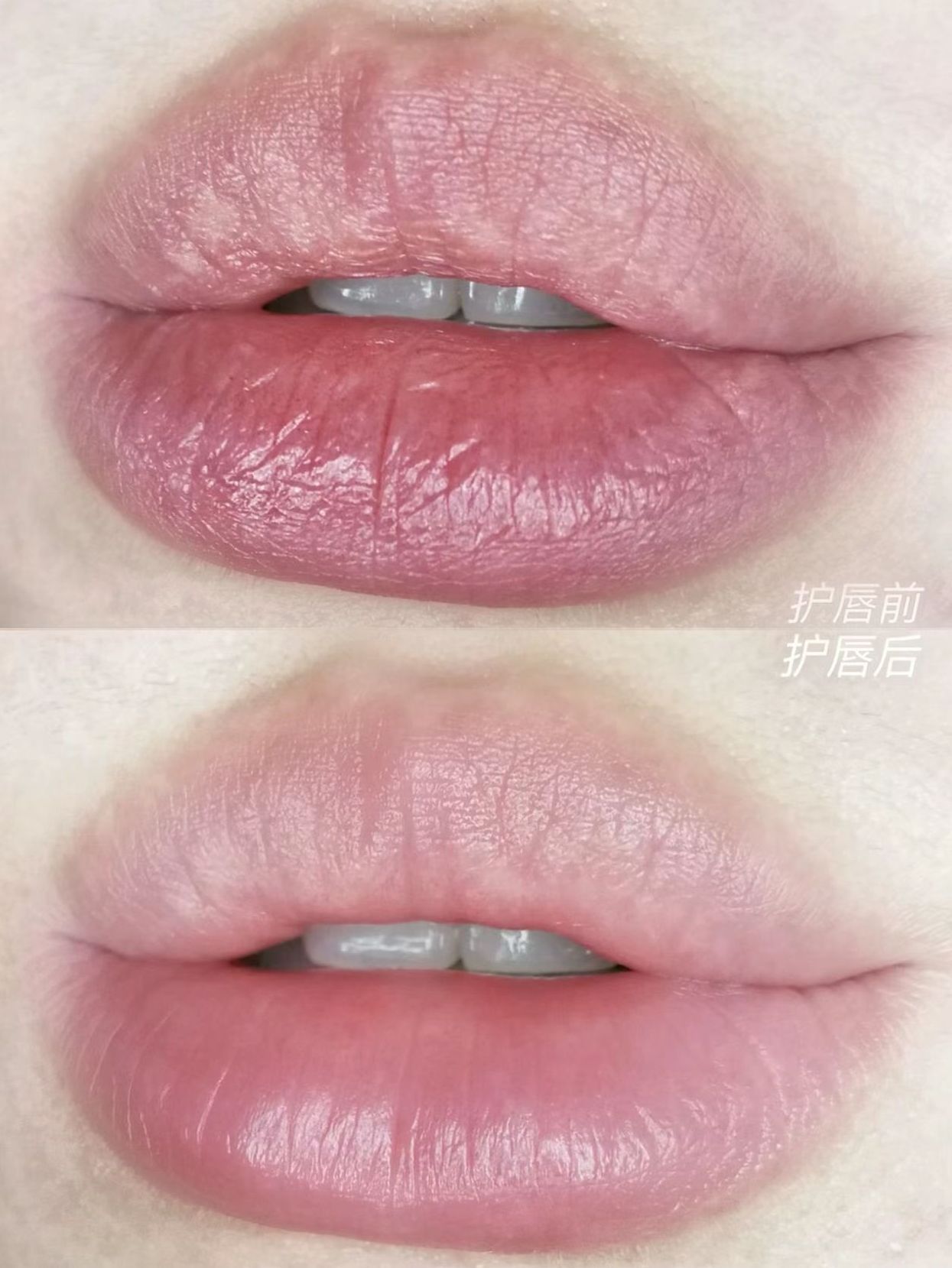 嘴巴子嫩成果冻啦‼️宝藏护唇好物😆