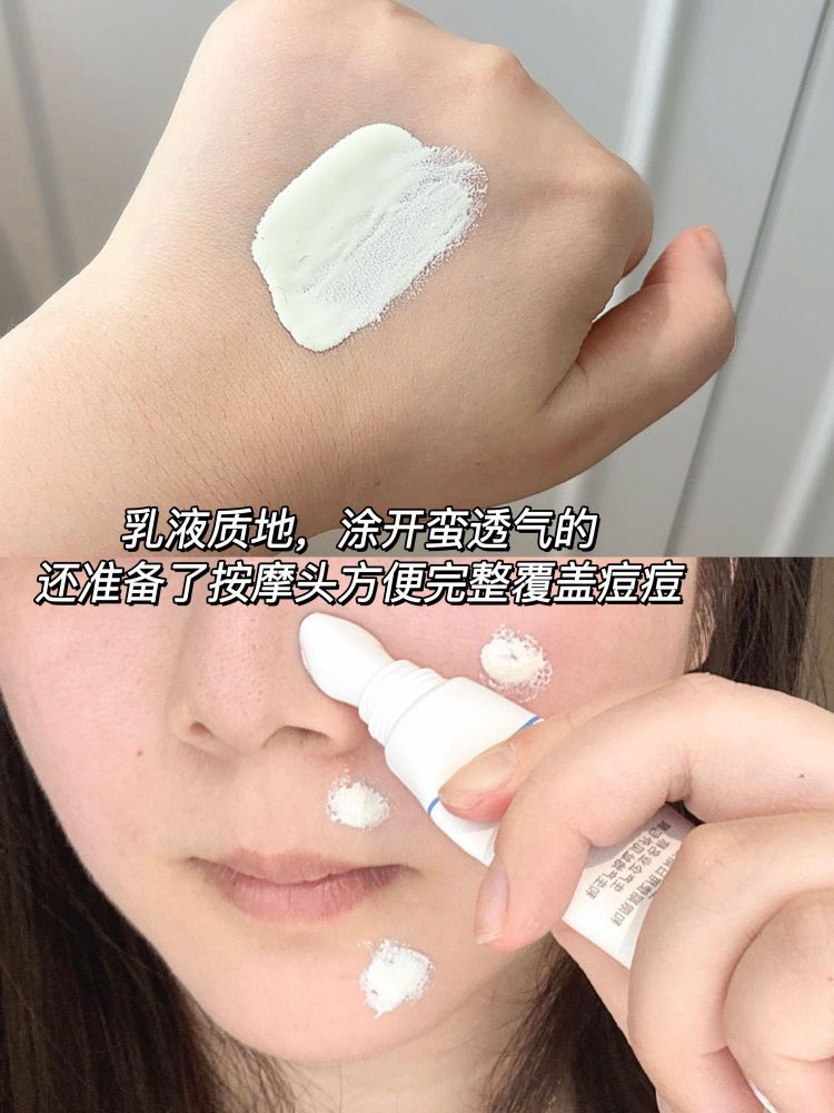 和痘肌和解了!这个夏天我强到可怕!