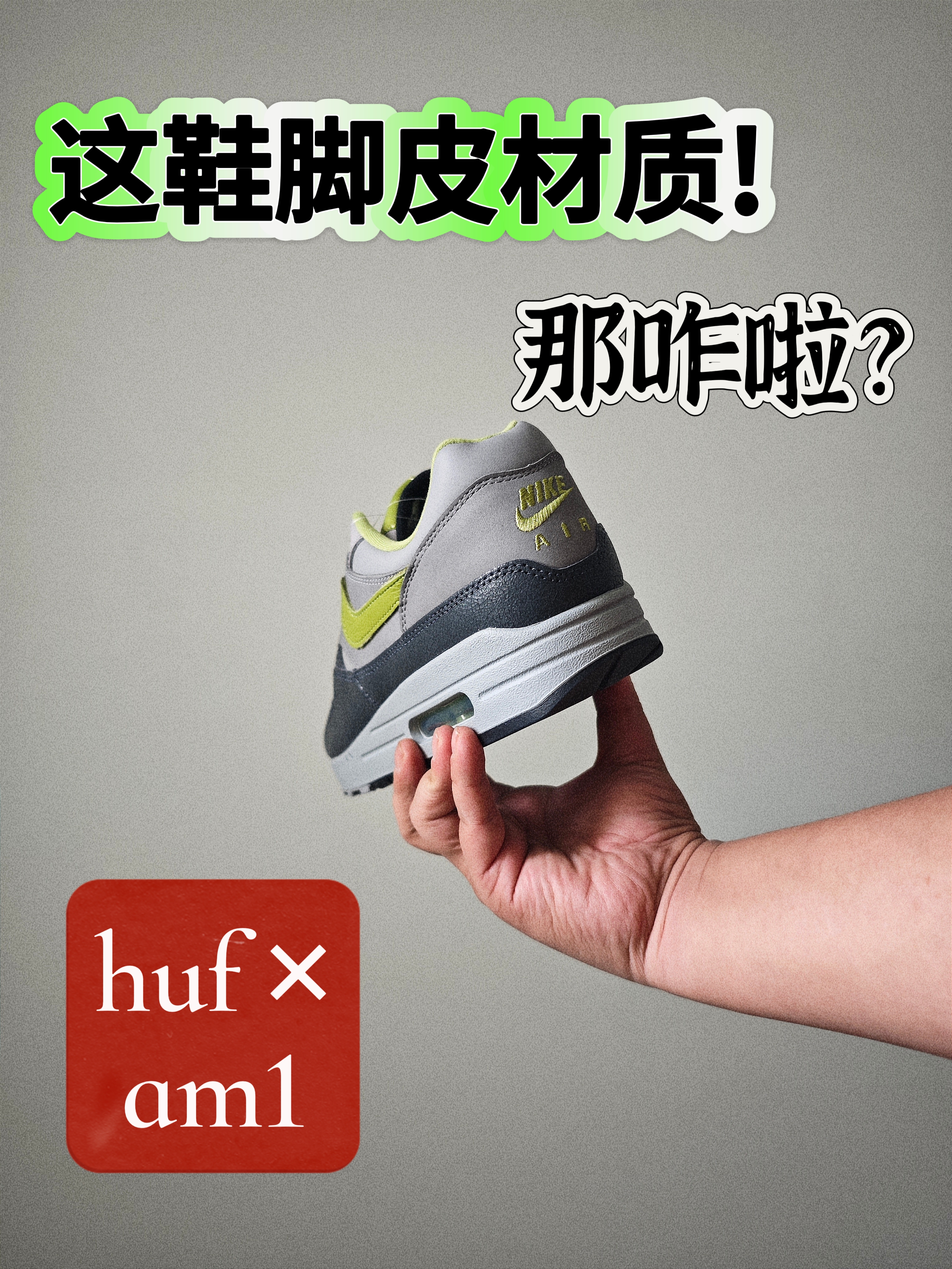 虽然是脚皮，但是我喜欢呀