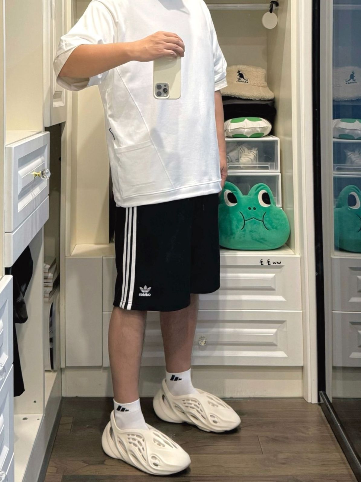 条纹短裤/白袜/洞洞鞋穿搭