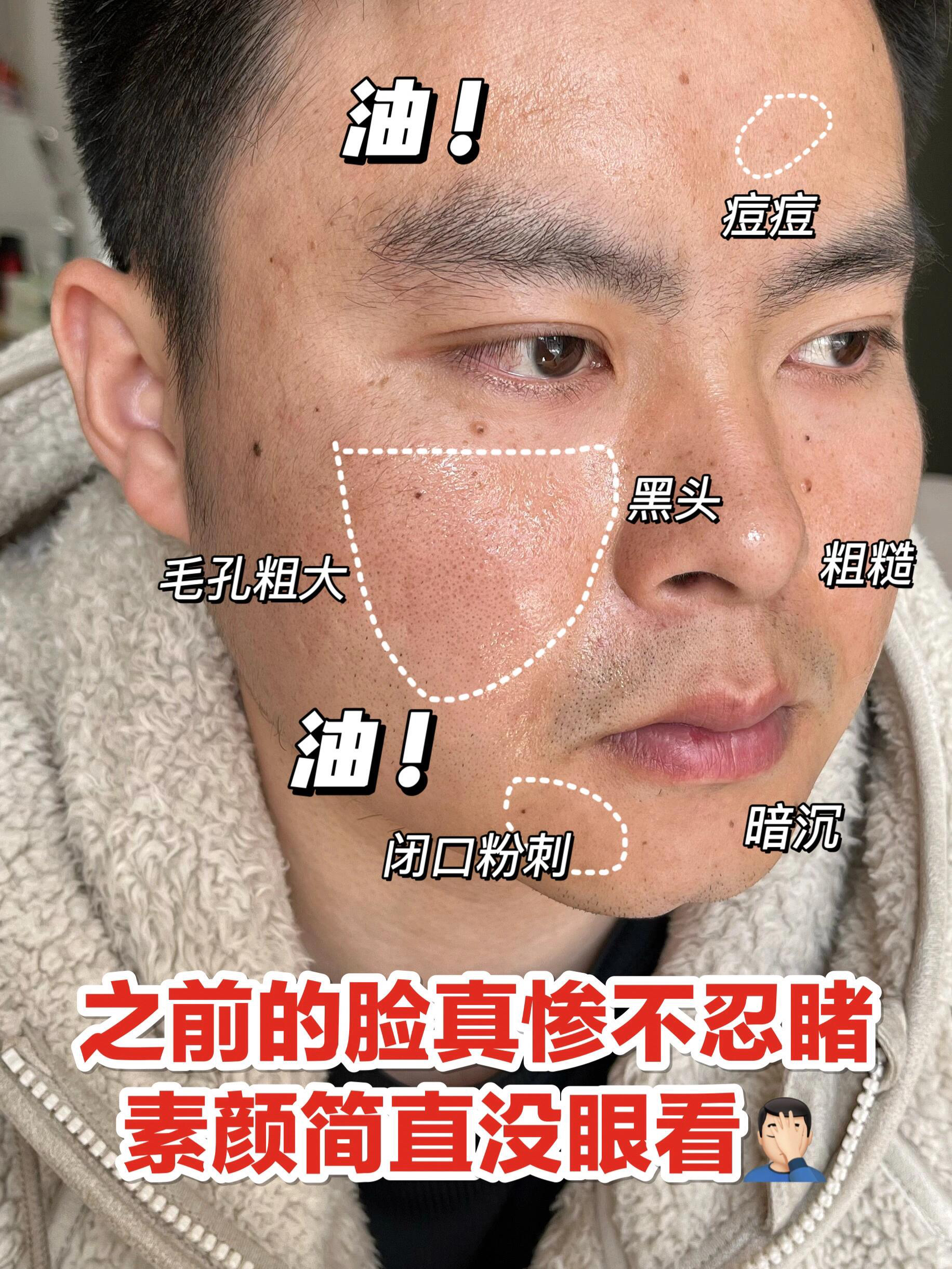 三步摆脱油腻！这套男士护肤品真的绝！