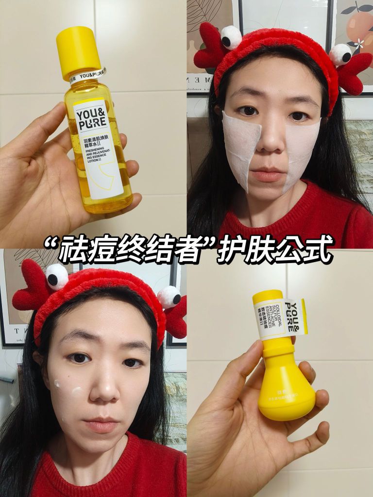我宣布这是我发现最🈶效的“祛痘终结者”了