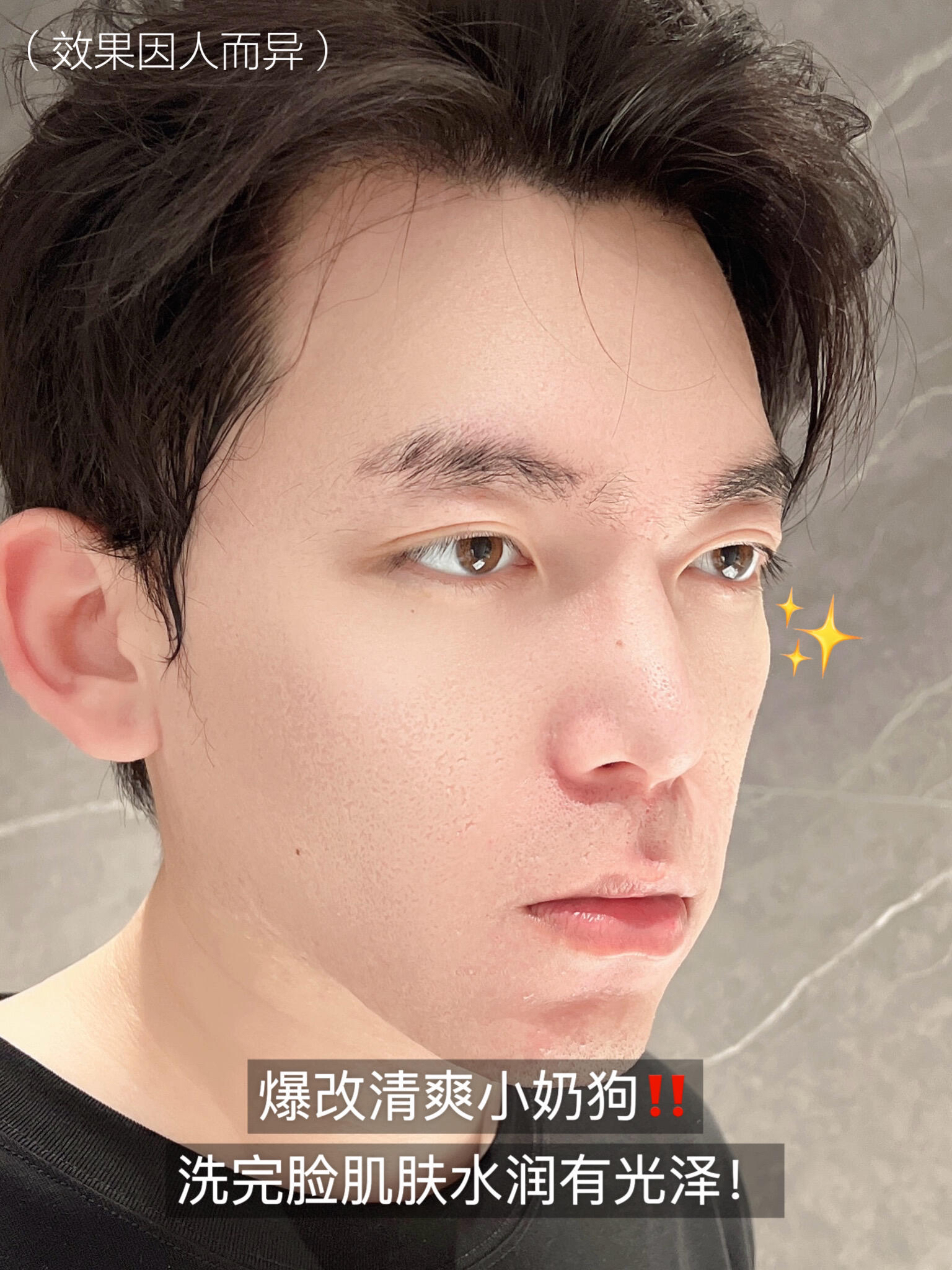 控油祛痘巨猛‼️跪求油痘肌男生试试它！