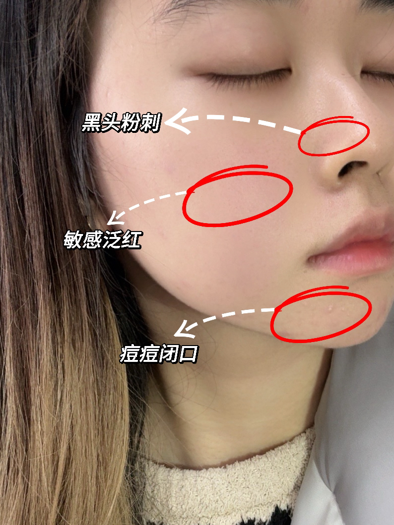 这样的脸还能救回来吗？！真的哭了…