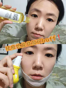 油痘肌一定要听劝❗祛痘也要叠加双buff……