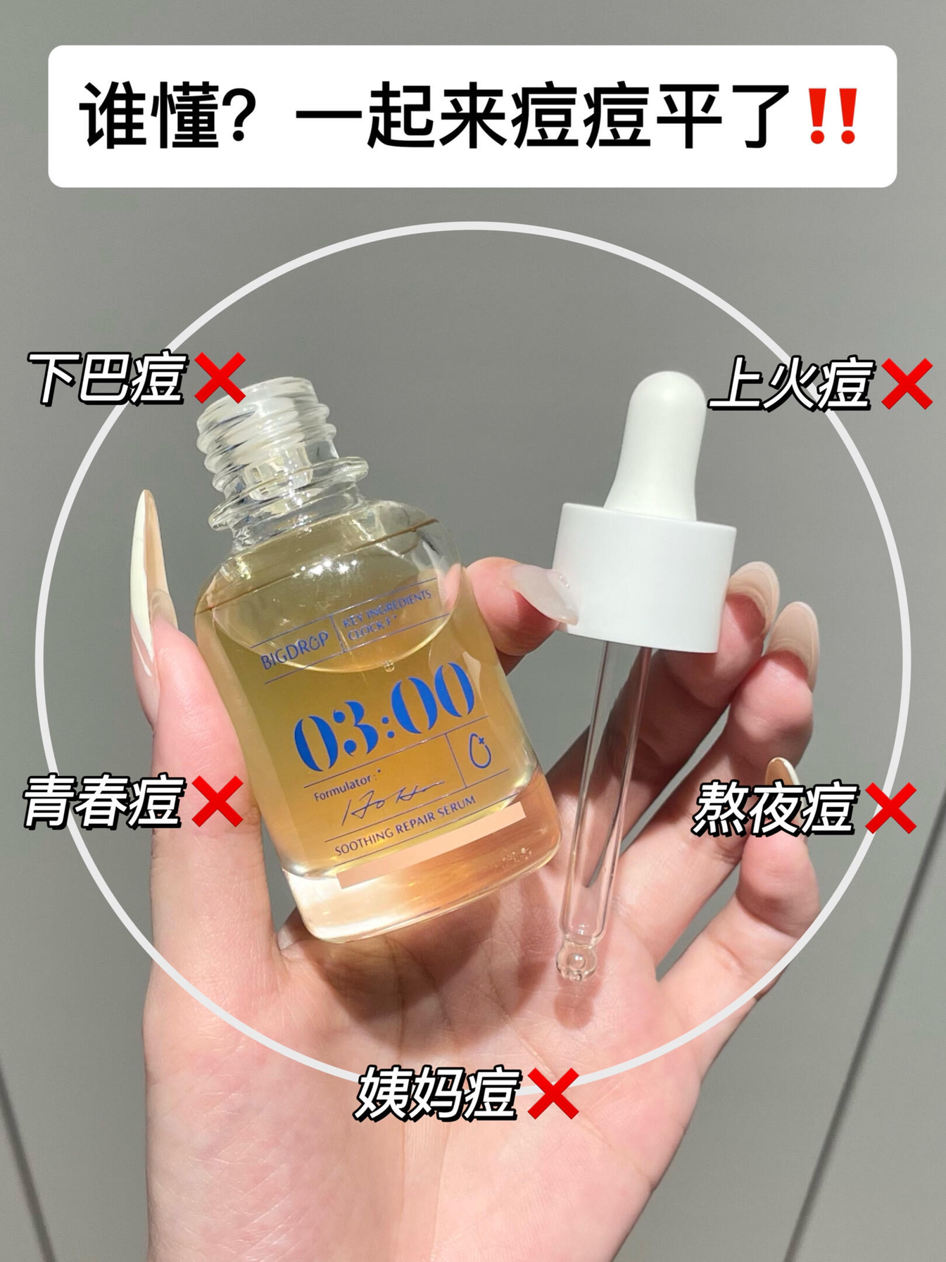油痘肌应该人手一支！祛痘牛的一批！