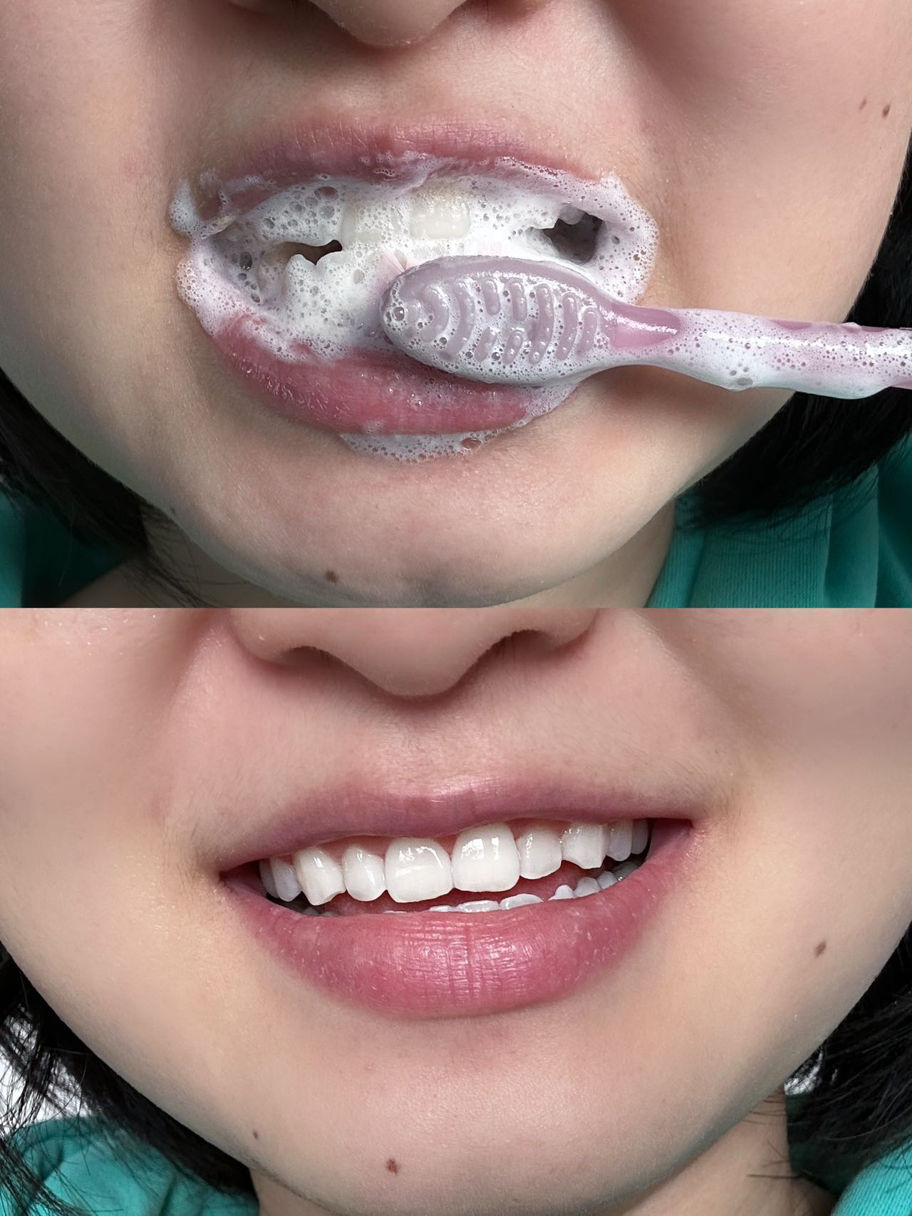 口无异味！尊滴会笑得更甜耶