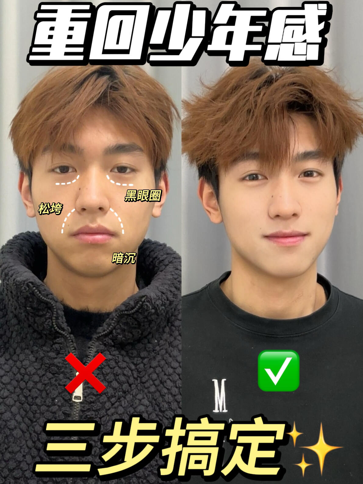 寒假逆袭‼️三步养成好皮肤✨