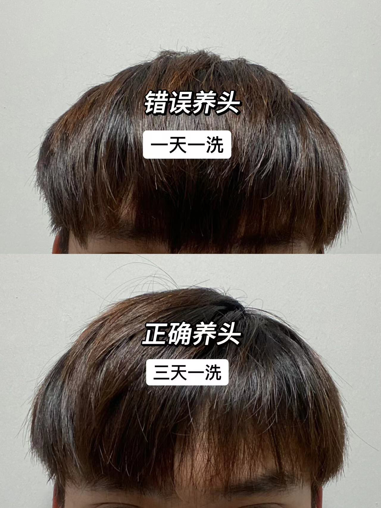 终于告别油扁塌啦