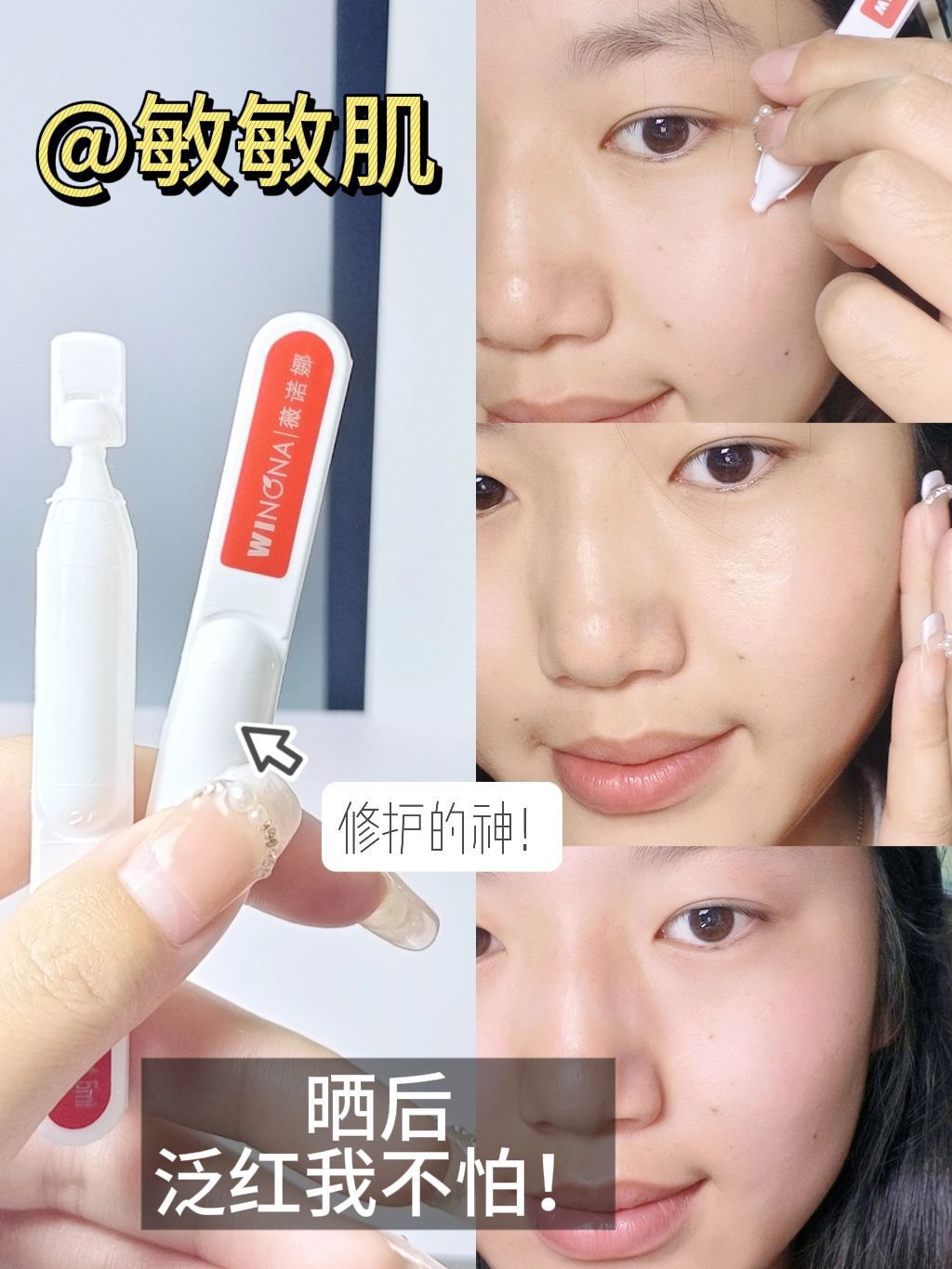薇诺娜…离了你谁还帮我改善晒后敏感泛红