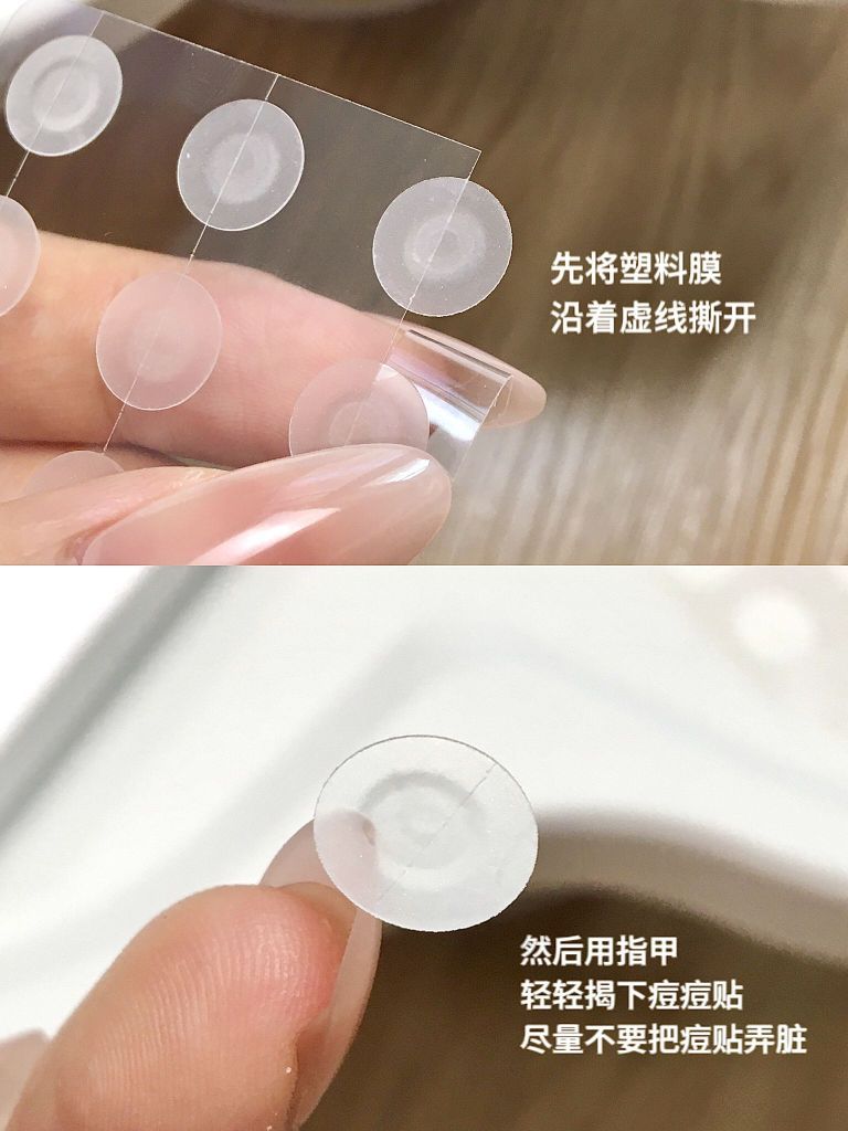 小预算祛痘攻略震撼来袭！📸这痘痘贴我寻思谁琢磨出来的呢..
