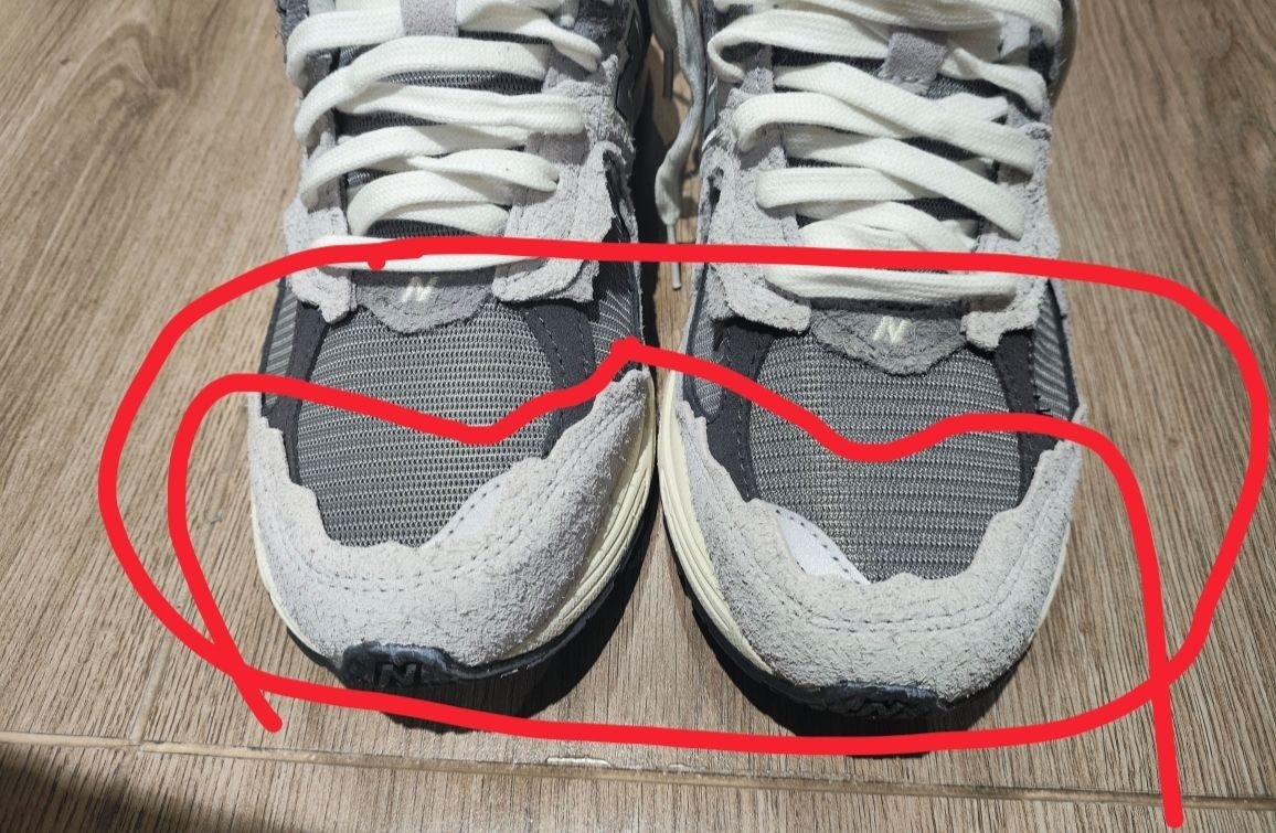 这是正常瑕疵吗？