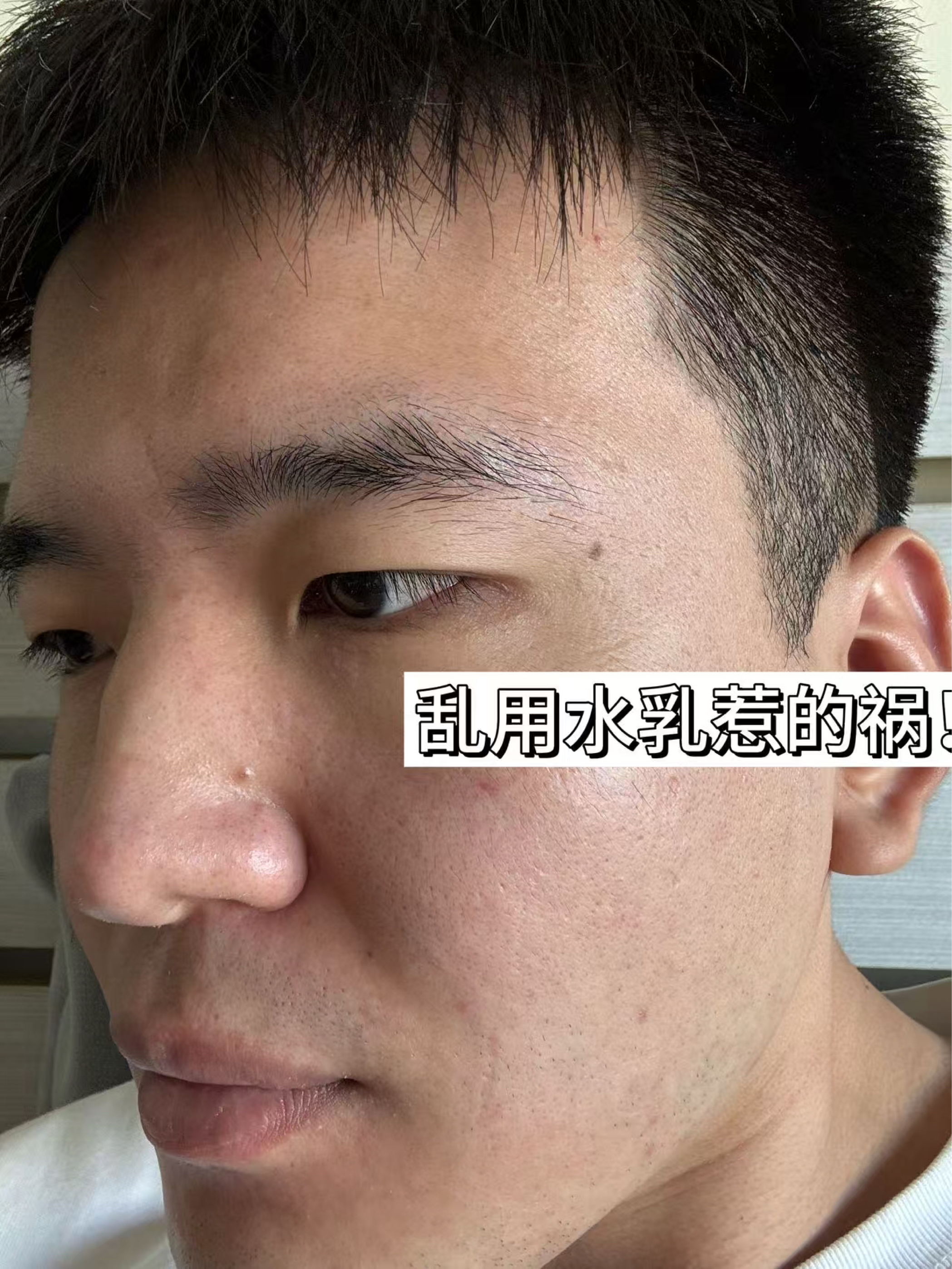 油痘肌男生的救星！护肤挖到宝