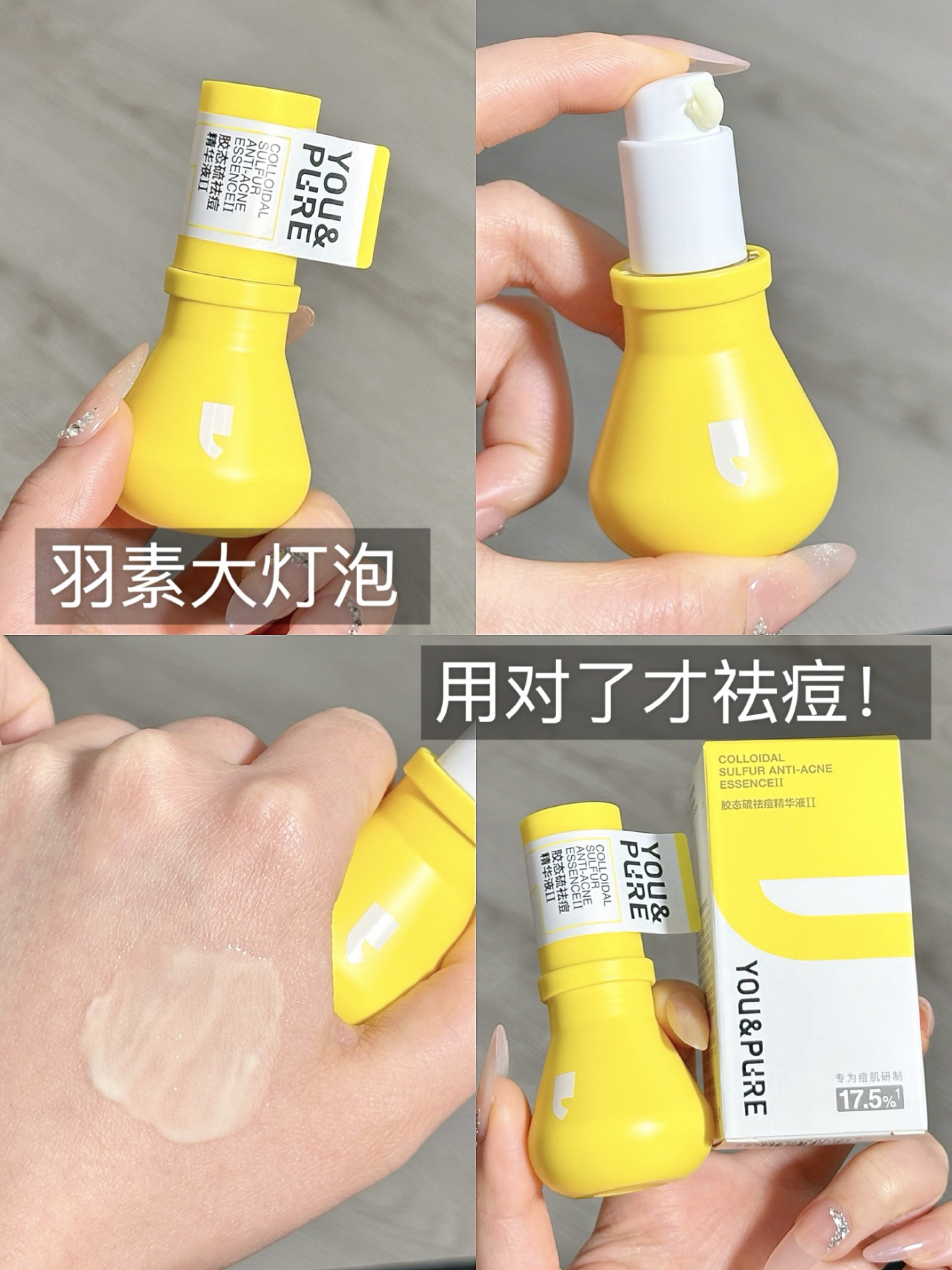 听劝！痘肌选对护肤品 祛痘事半功倍