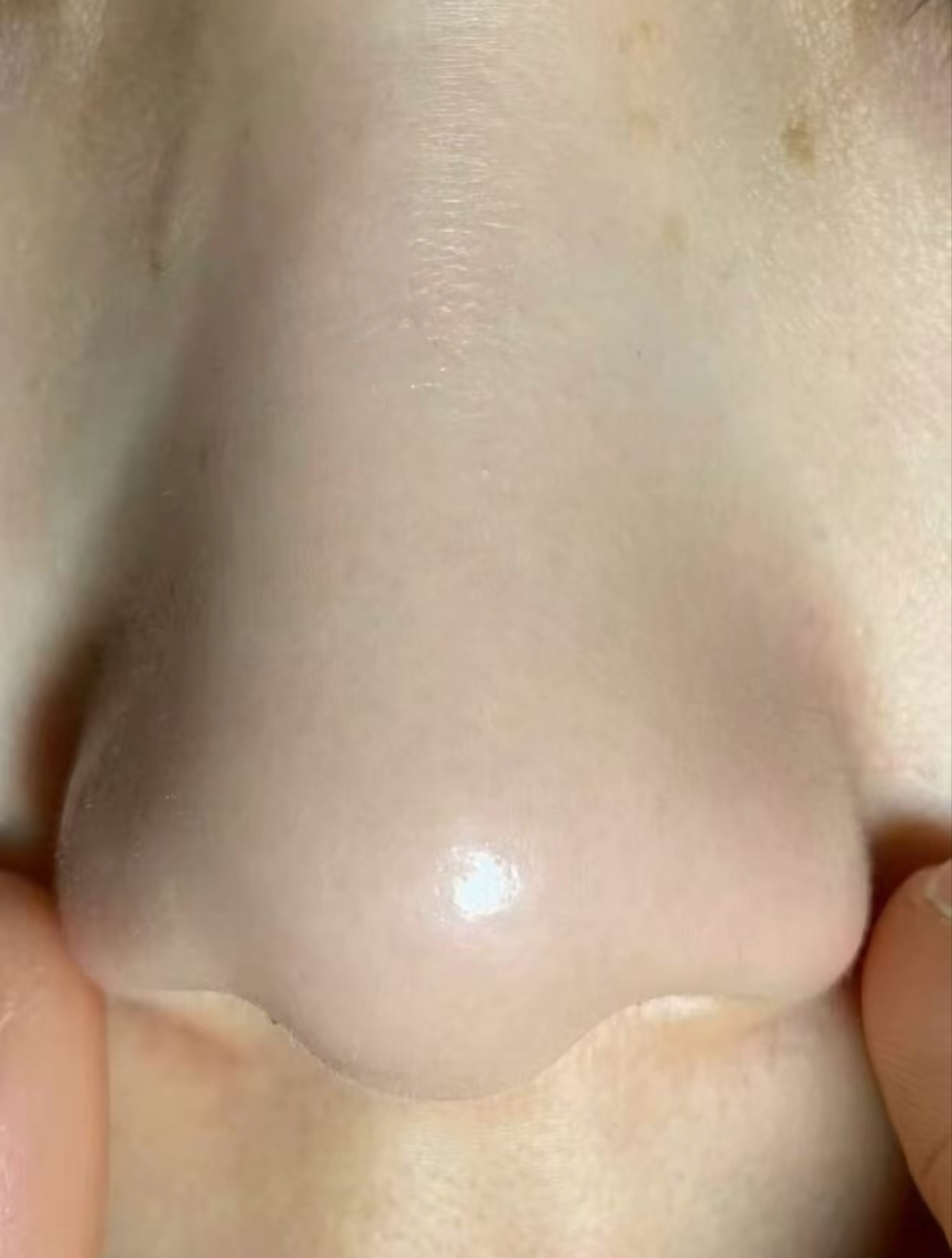 说实话…这好皮肤是我应得的