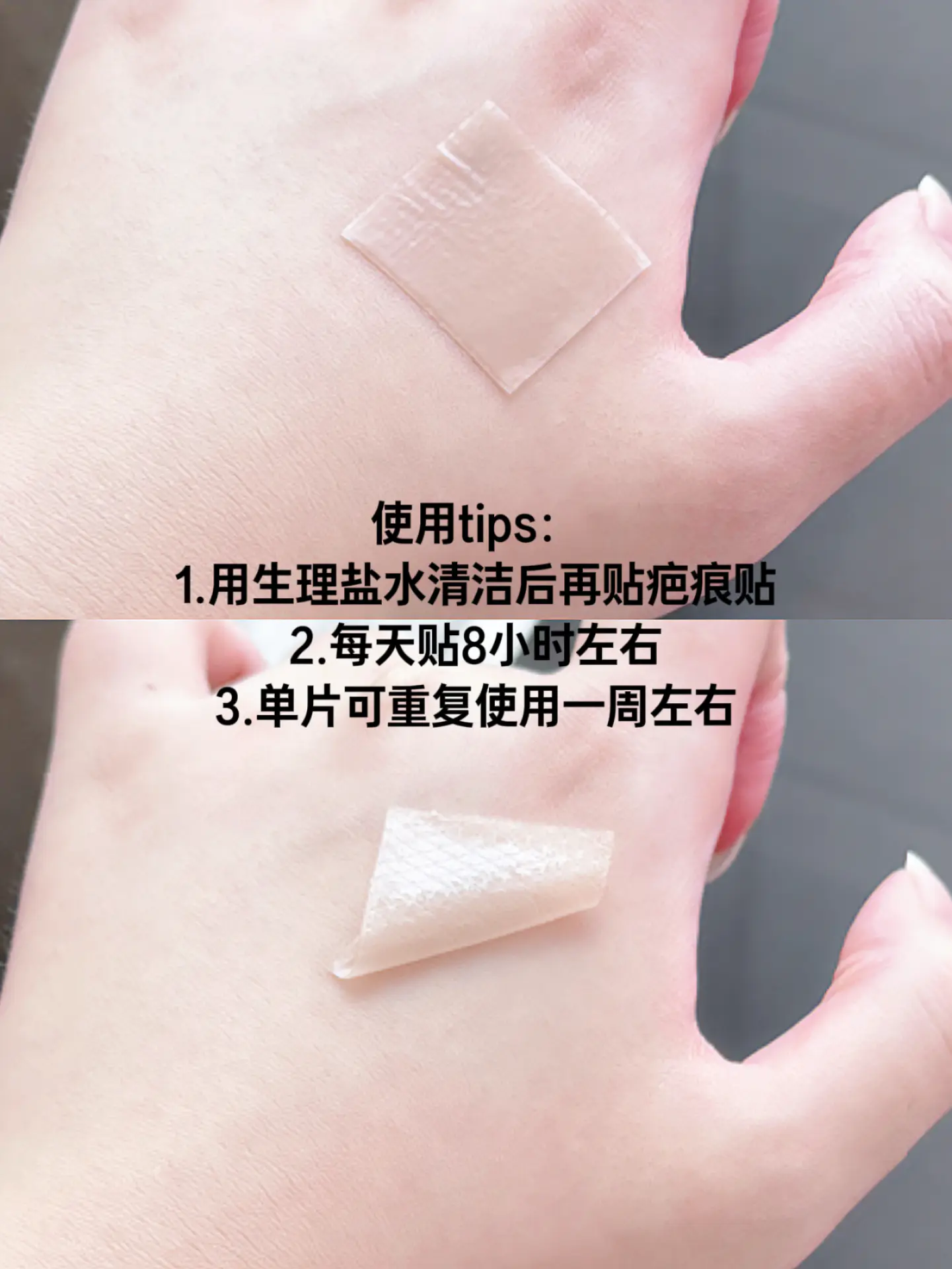 我看谁还在为疤痕苦恼